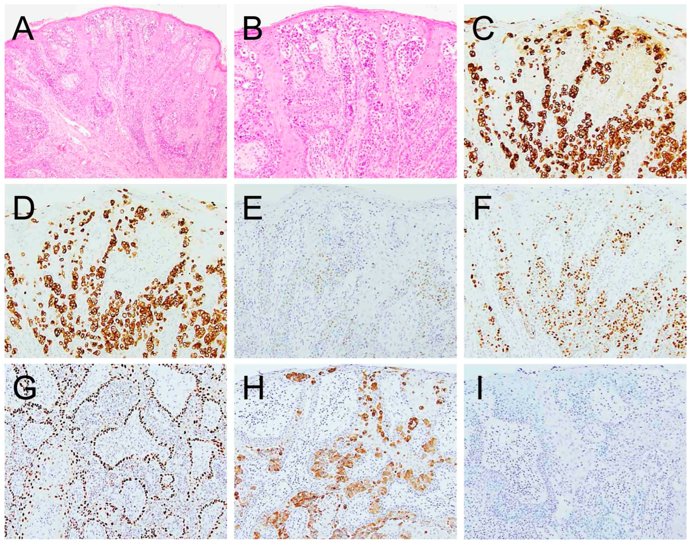 Cancers 17 04014 g004 Cancers 17 04014 g004