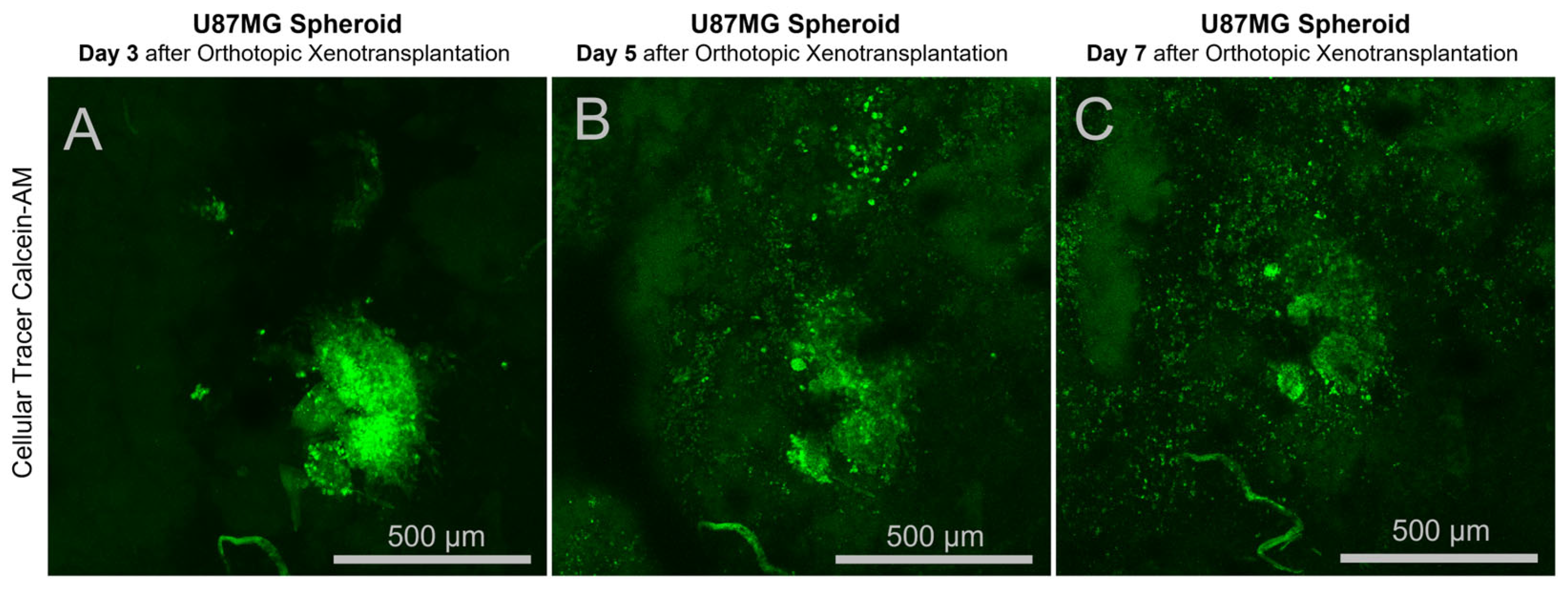 Cancers 17 04025 g006