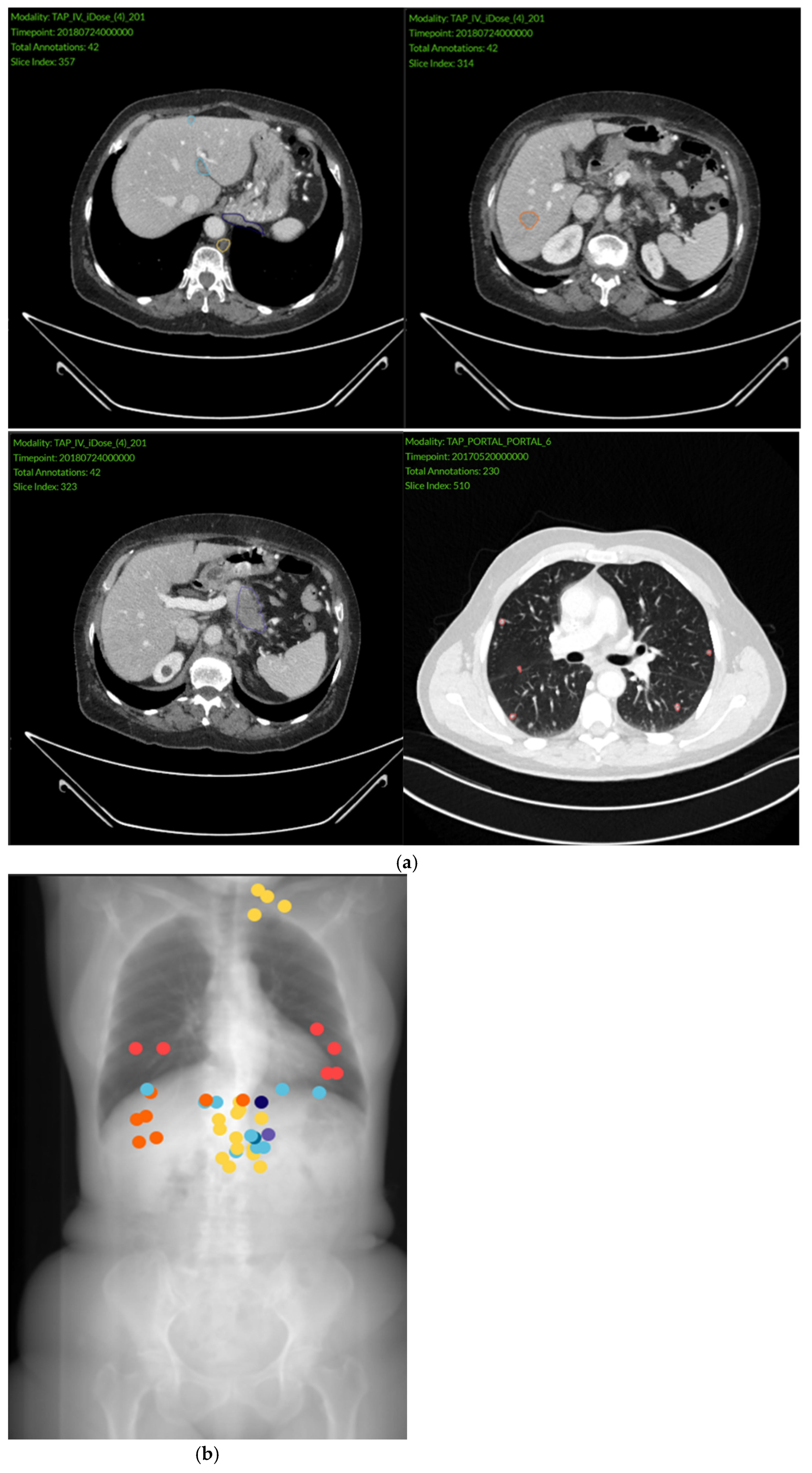 Cancers 18 00020 g002