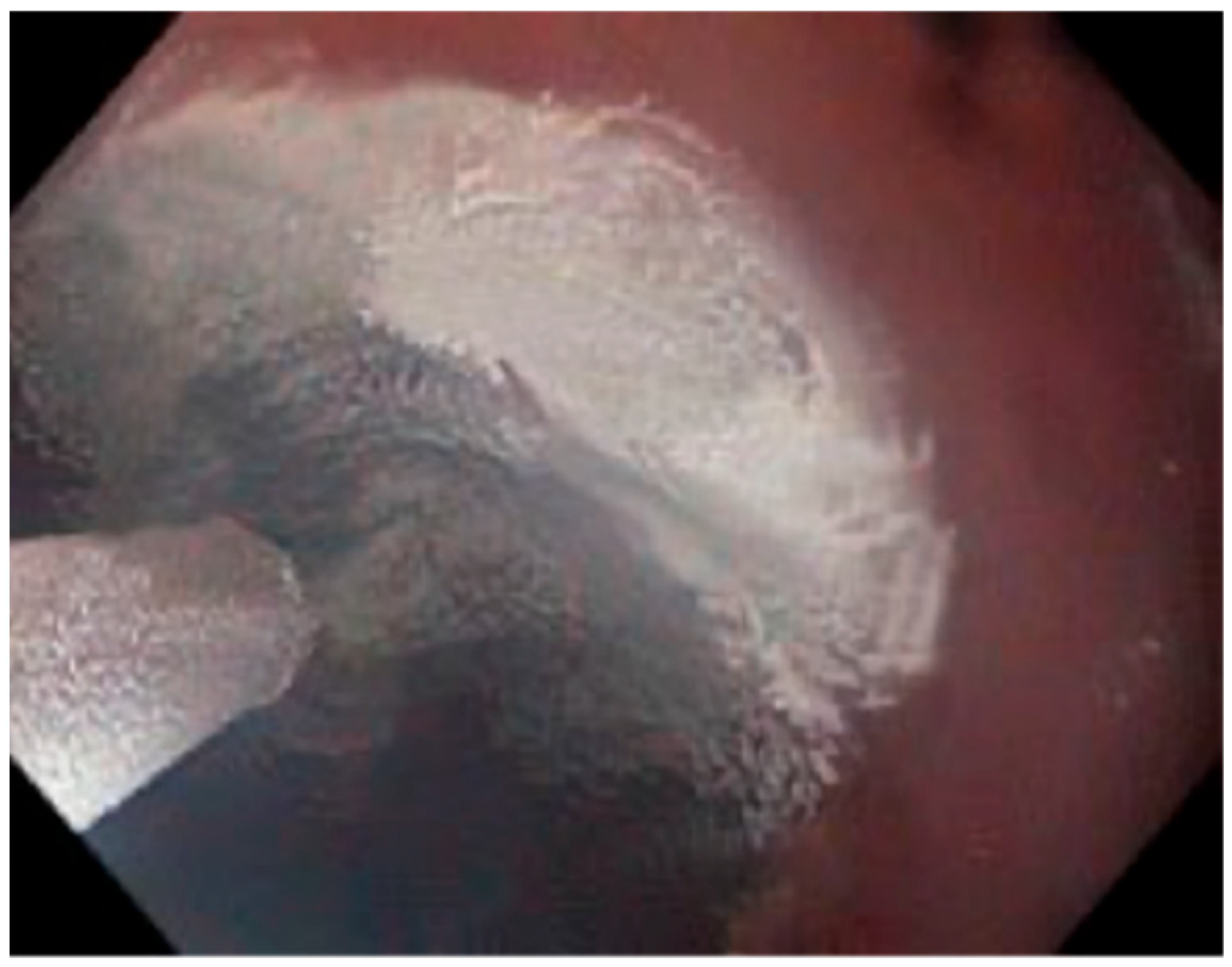 Cancers 18 00059 g003