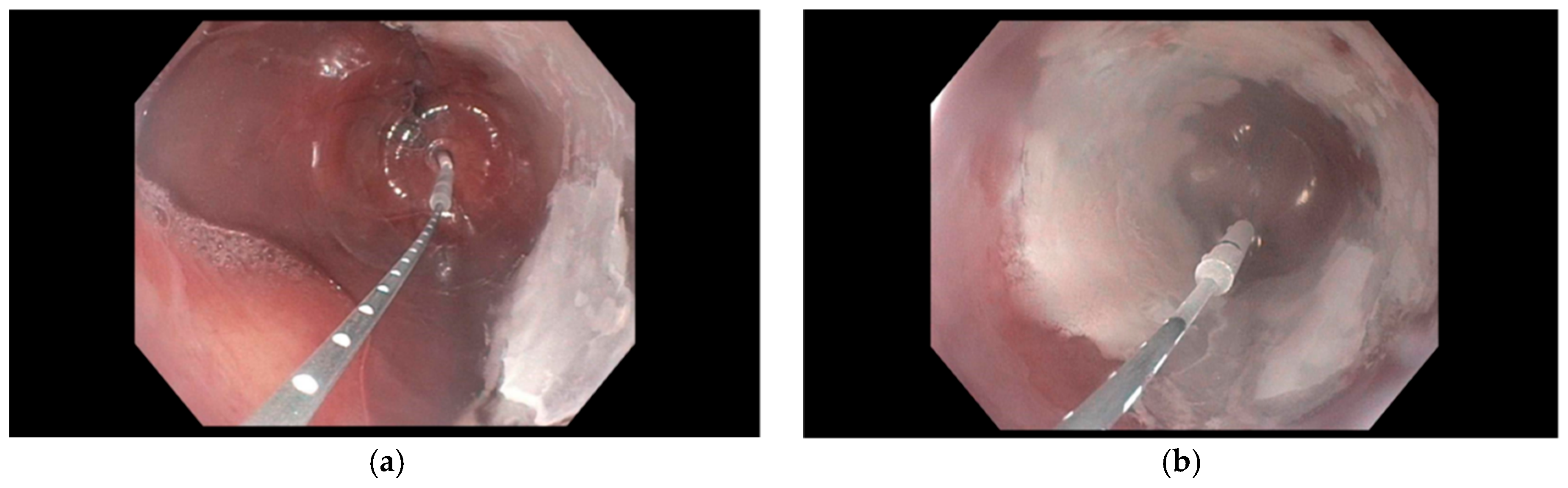 Cancers 18 00059 g005