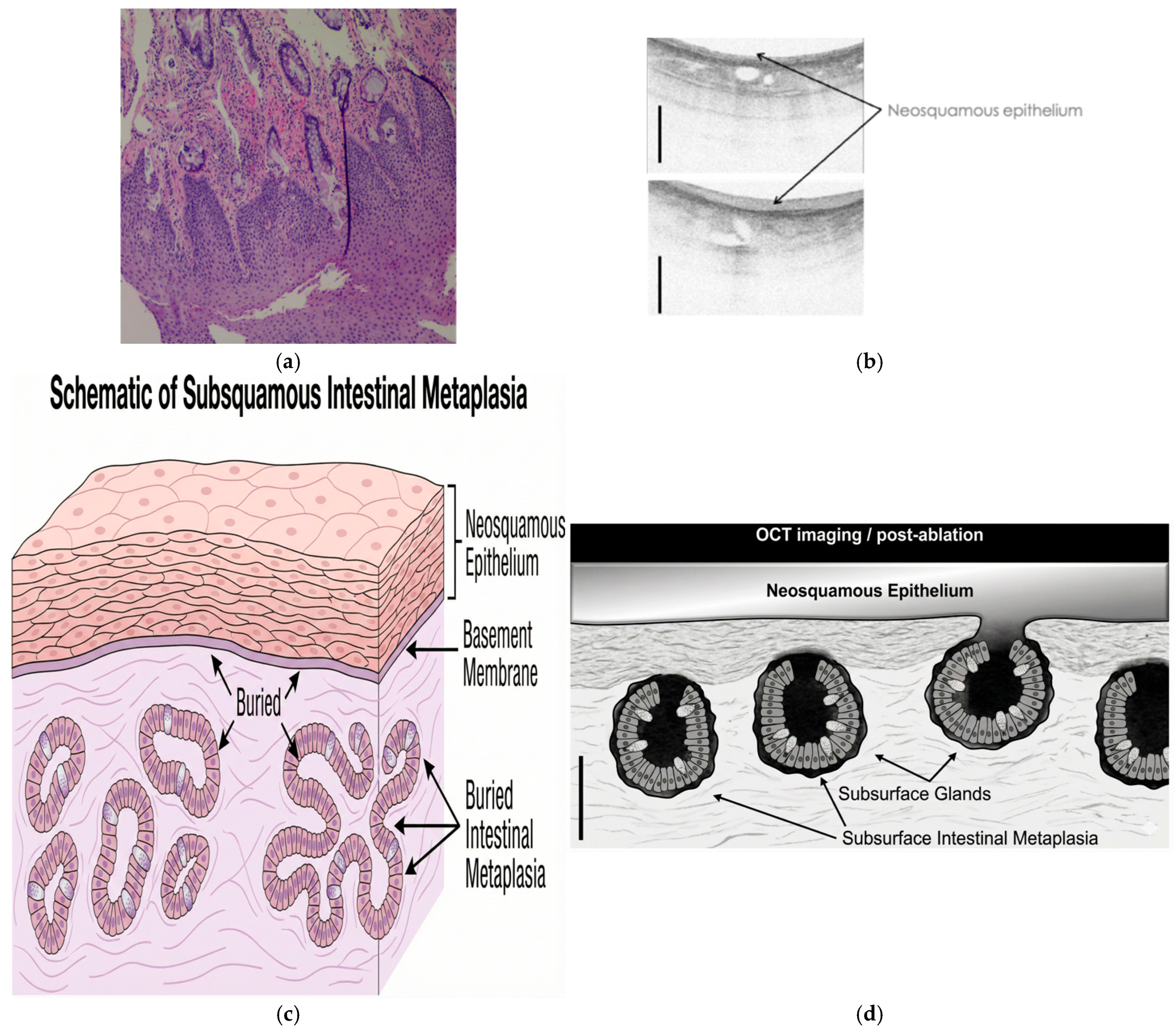 Cancers 18 00059 g006