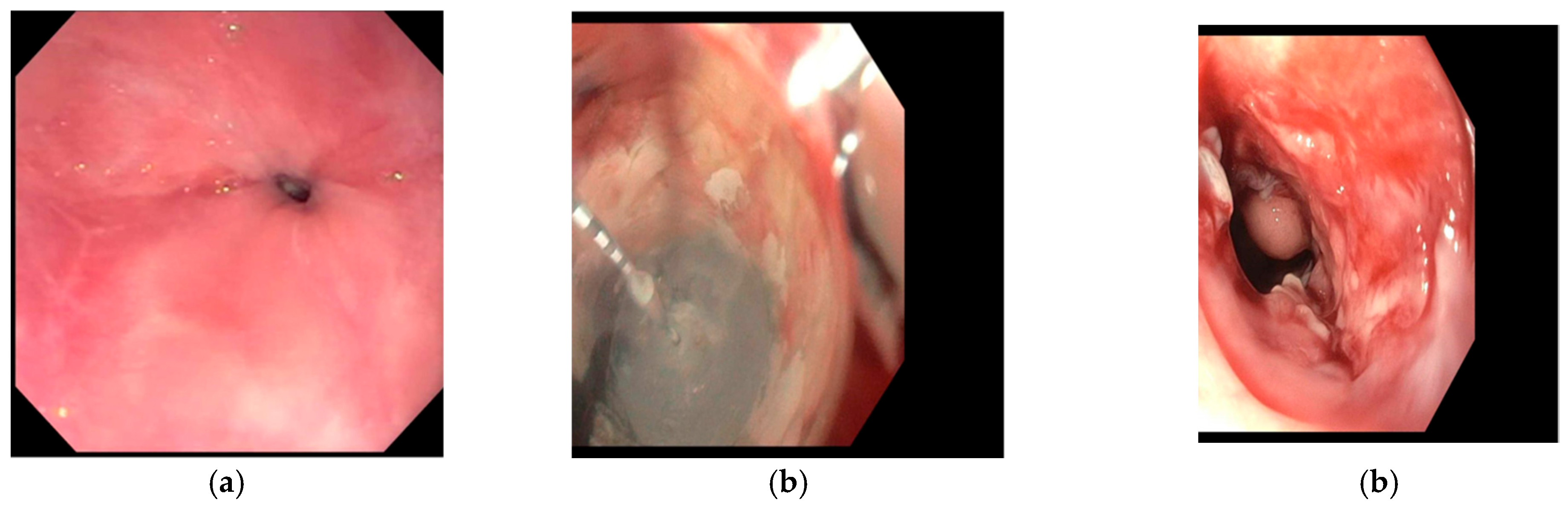 Cancers 18 00059 g007