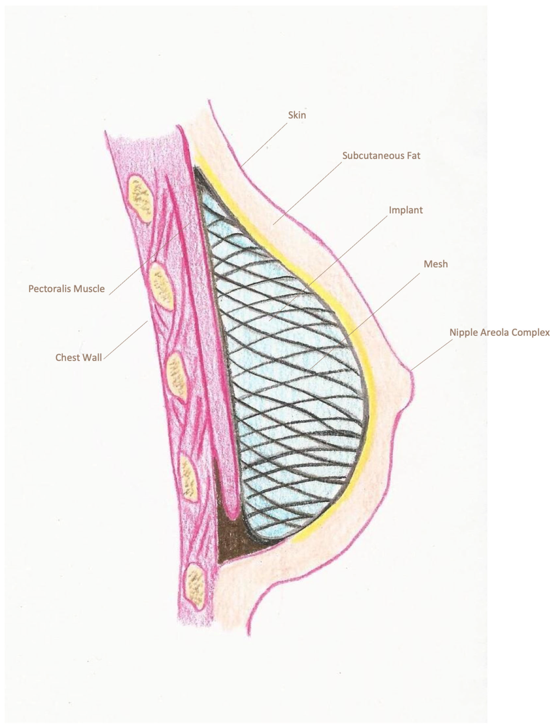 Cancers 18 00109 g003