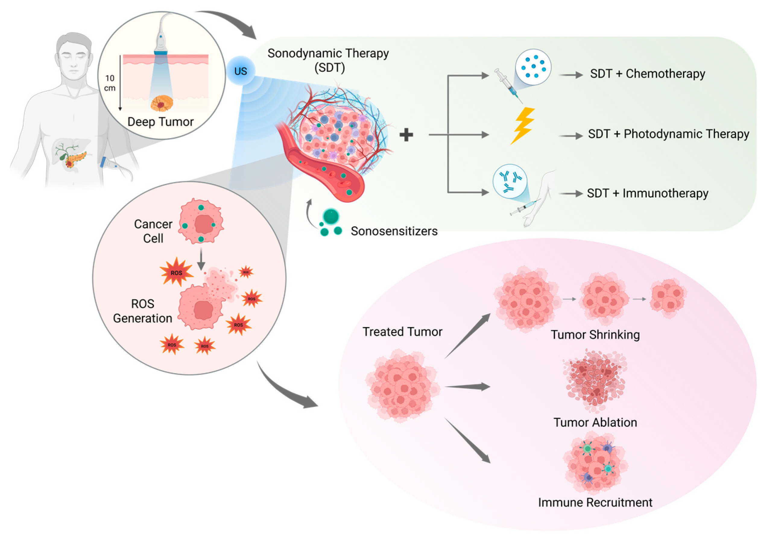 Cancers 18 00118 g001