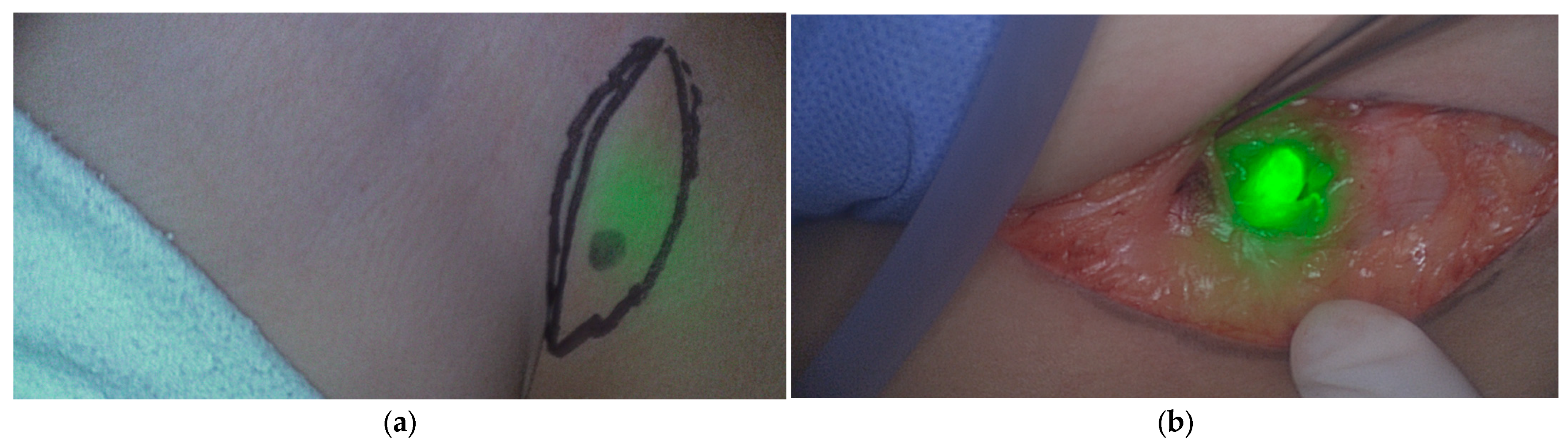 Cancers 18 00149 g003