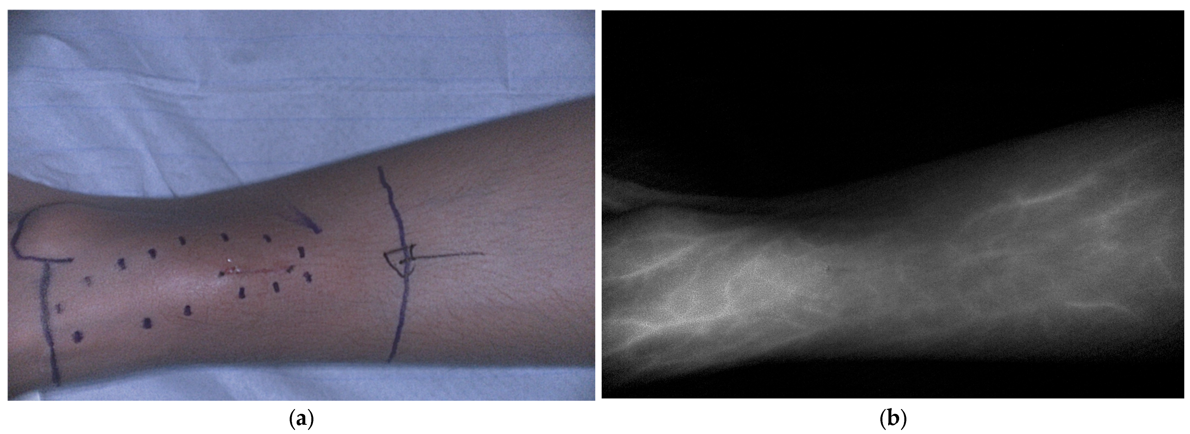 Cancers 18 00149 g004