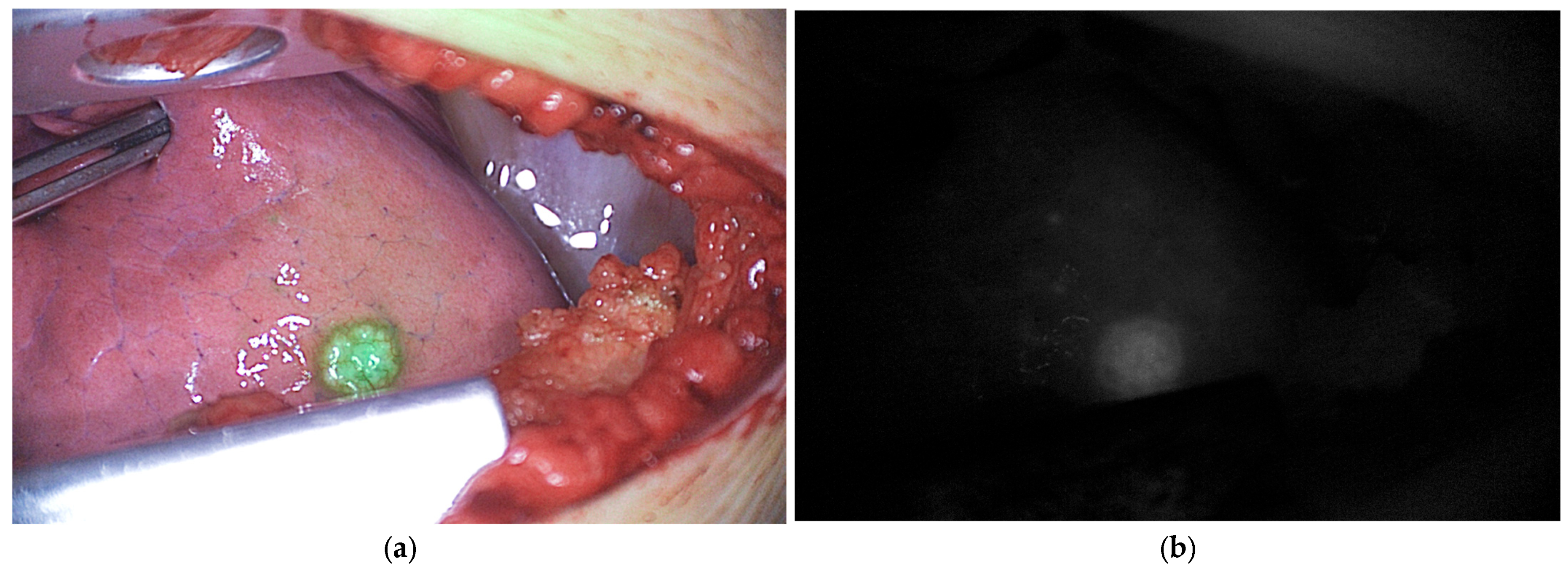 Cancers 18 00149 g005