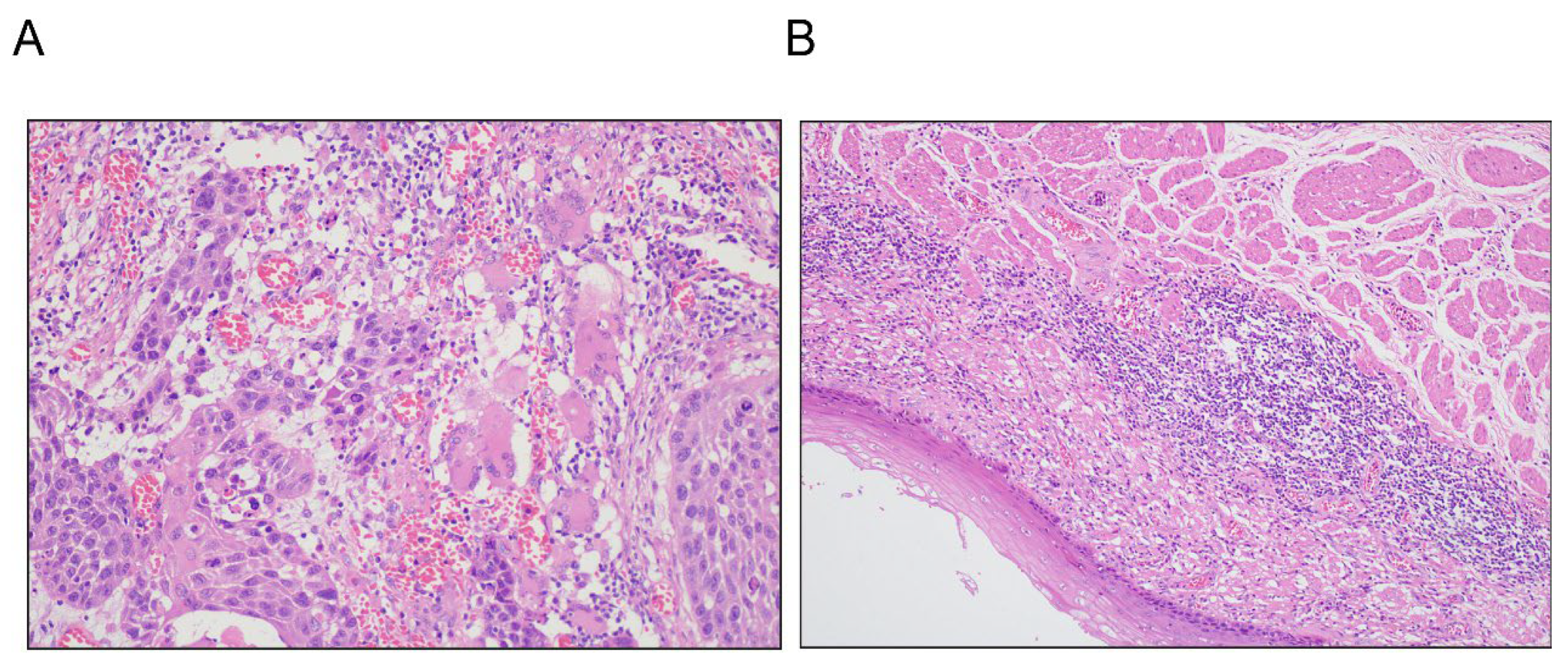Cancers 18 00155 g002 Cancers 18 00155 g002