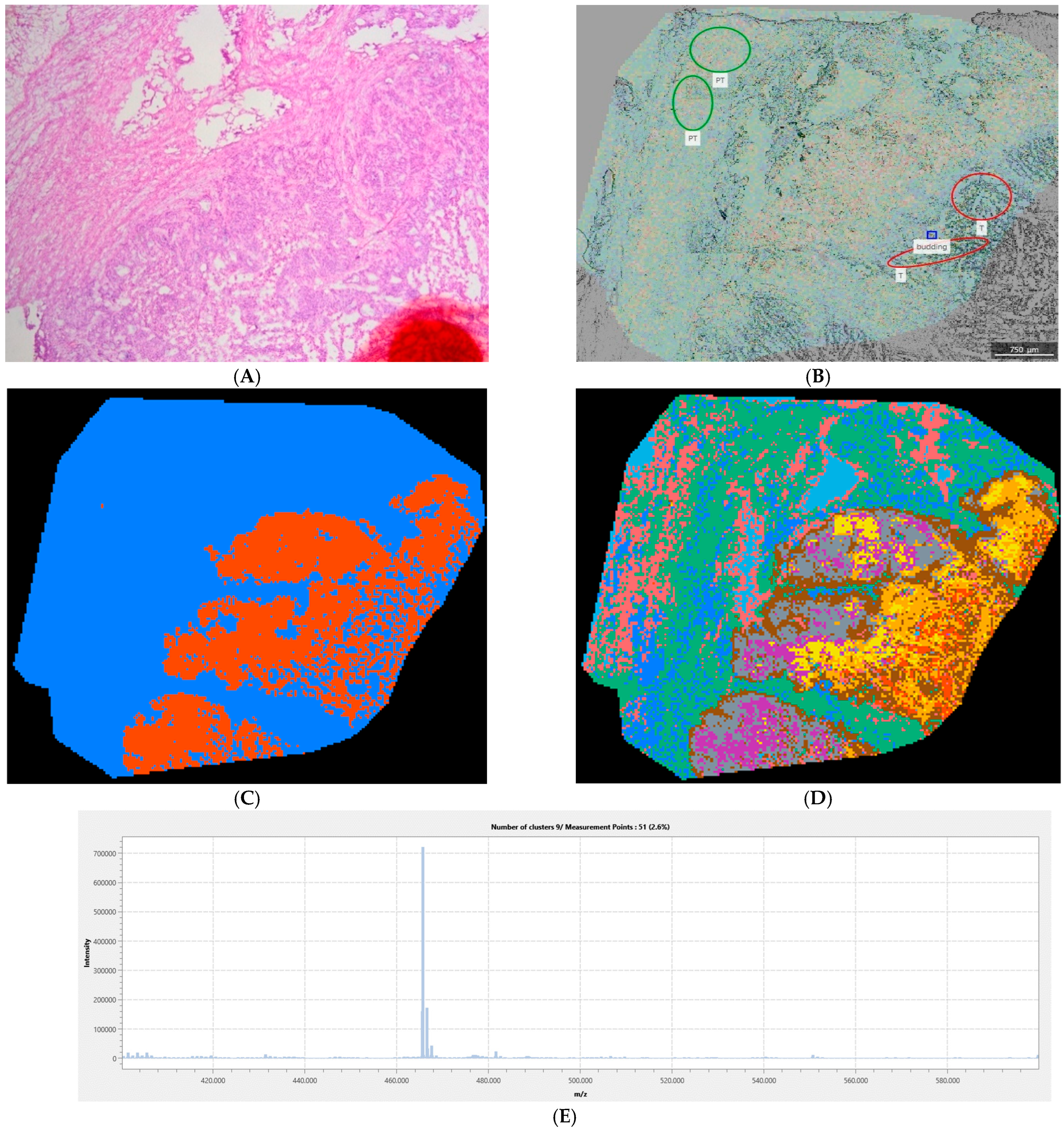 Cancers 18 00169 g003