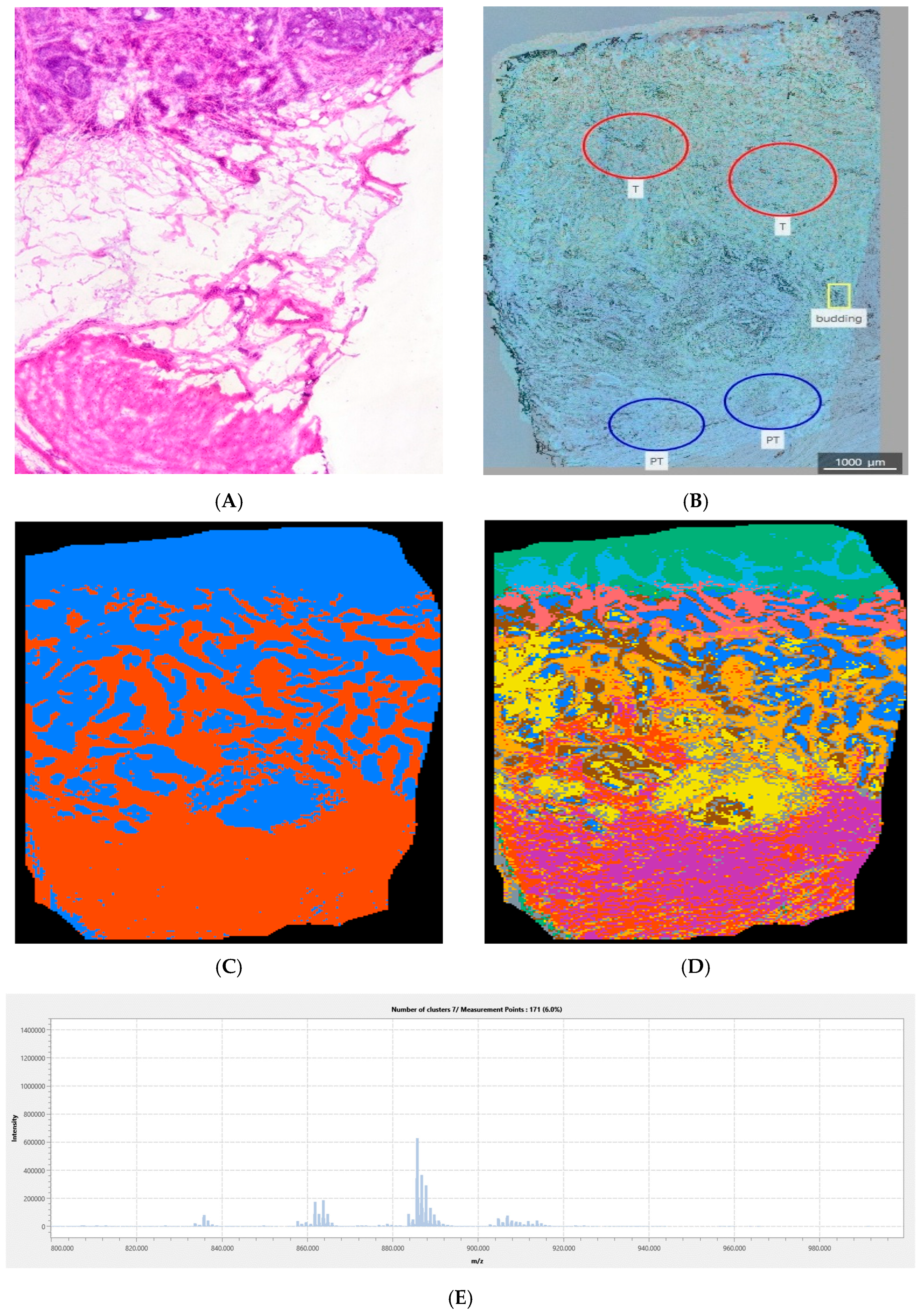 Cancers 18 00169 g005