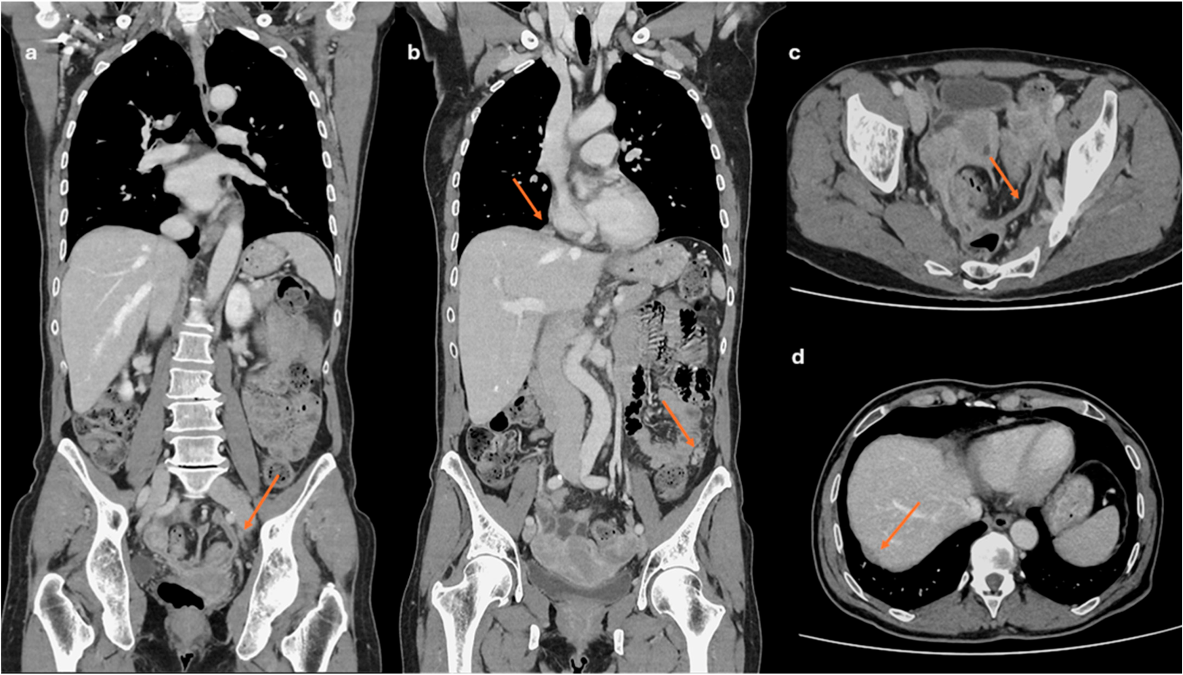 Cancers 18 00173 g002 Cancers 18 00173 g002