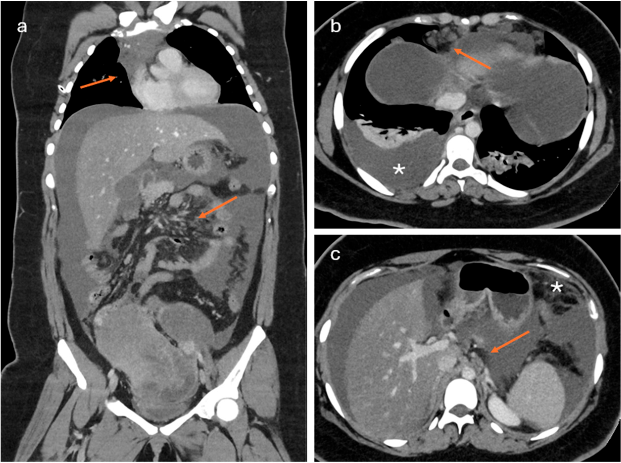 Cancers 18 00173 g003 Cancers 18 00173 g003