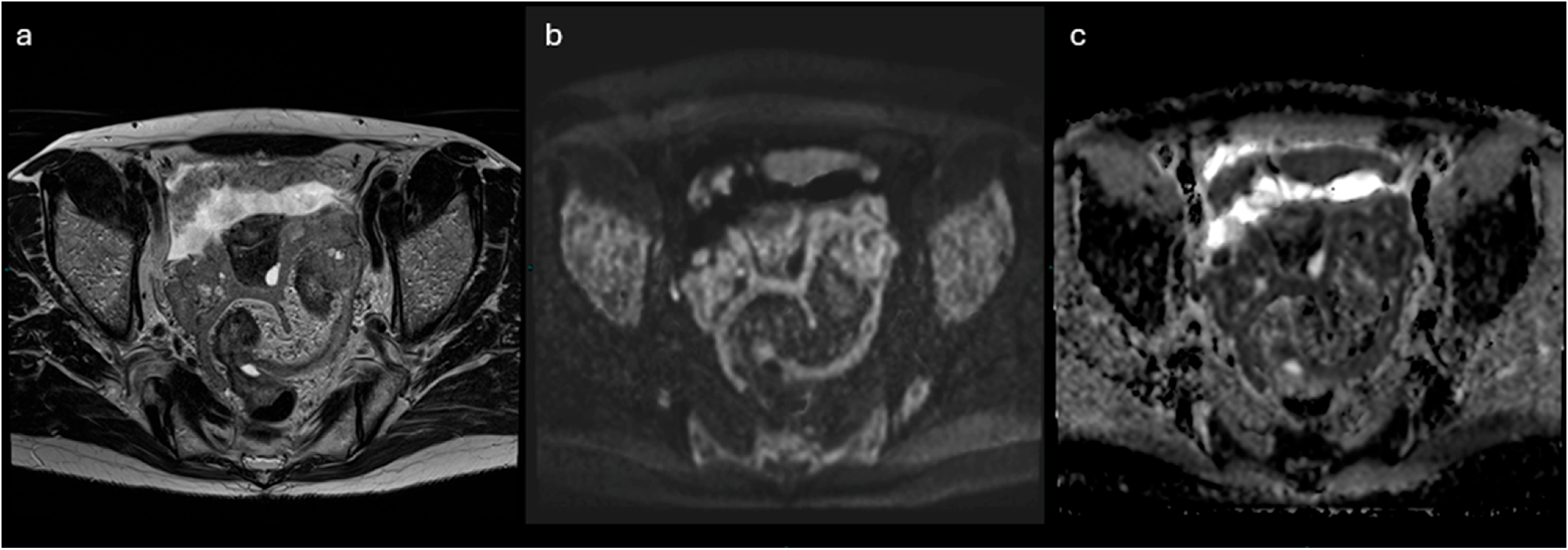 Cancers 18 00173 g007 Cancers 18 00173 g007