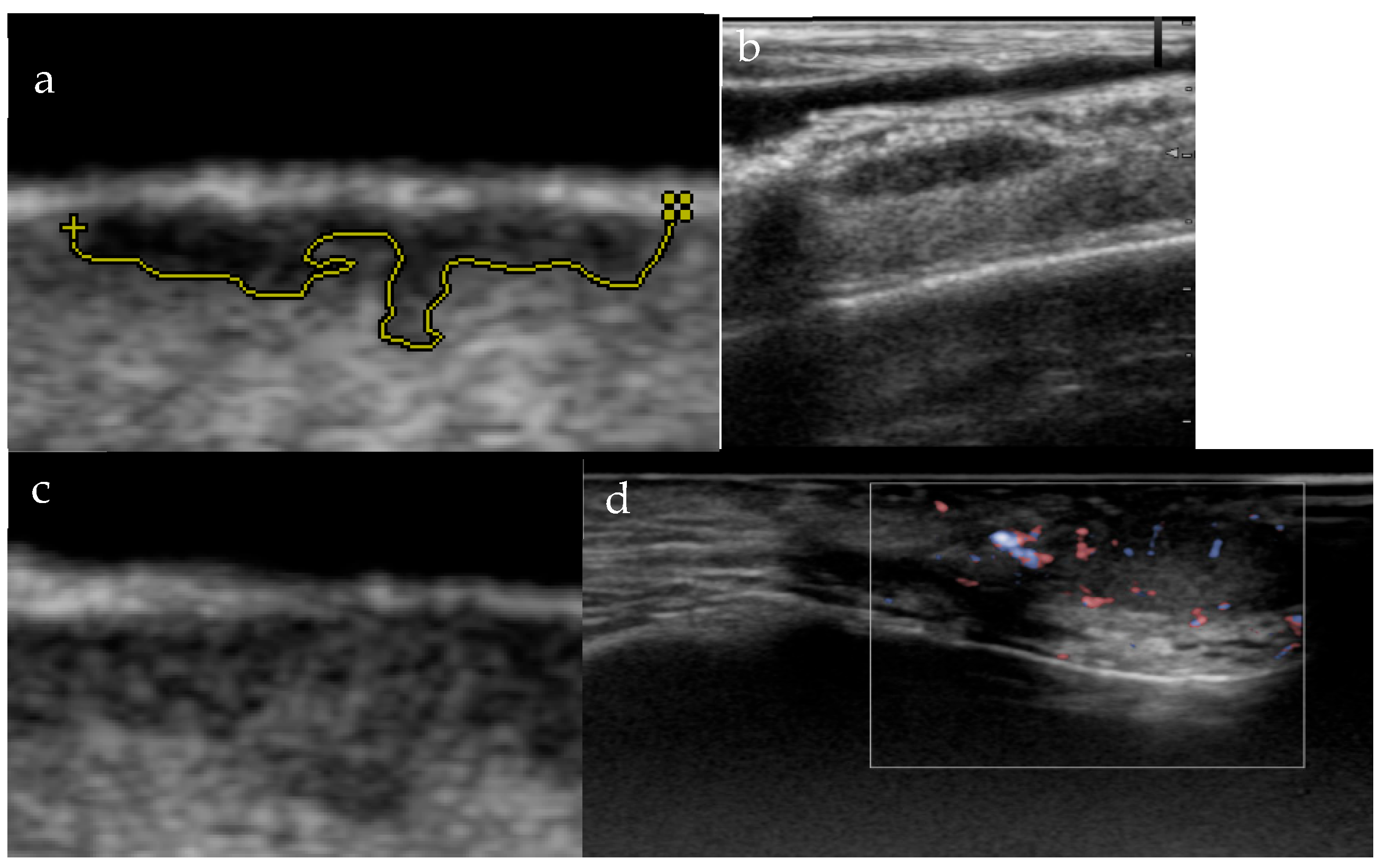 Cancers 18 00274 g002 Cancers 18 00274 g002