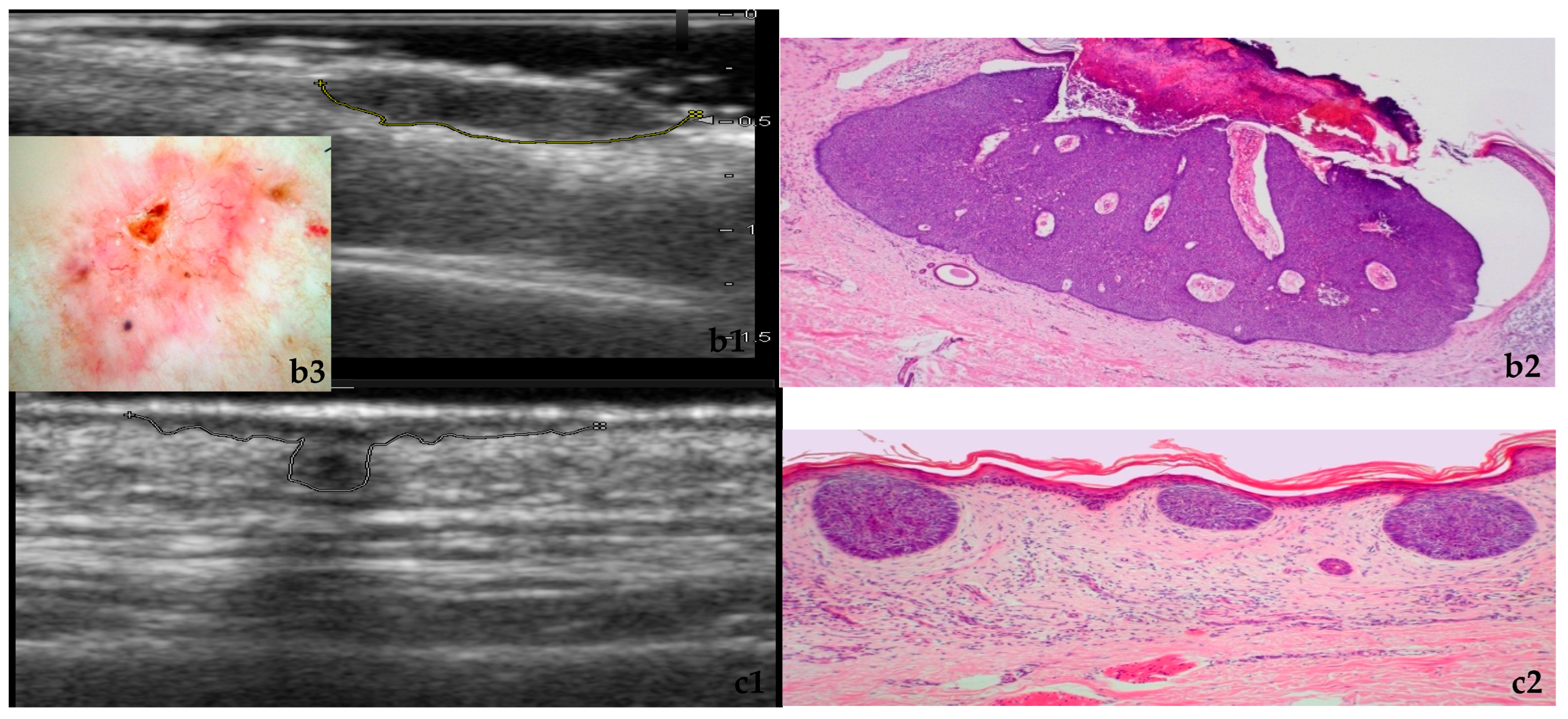 Cancers 18 00274 g003b Cancers 18 00274 g003b