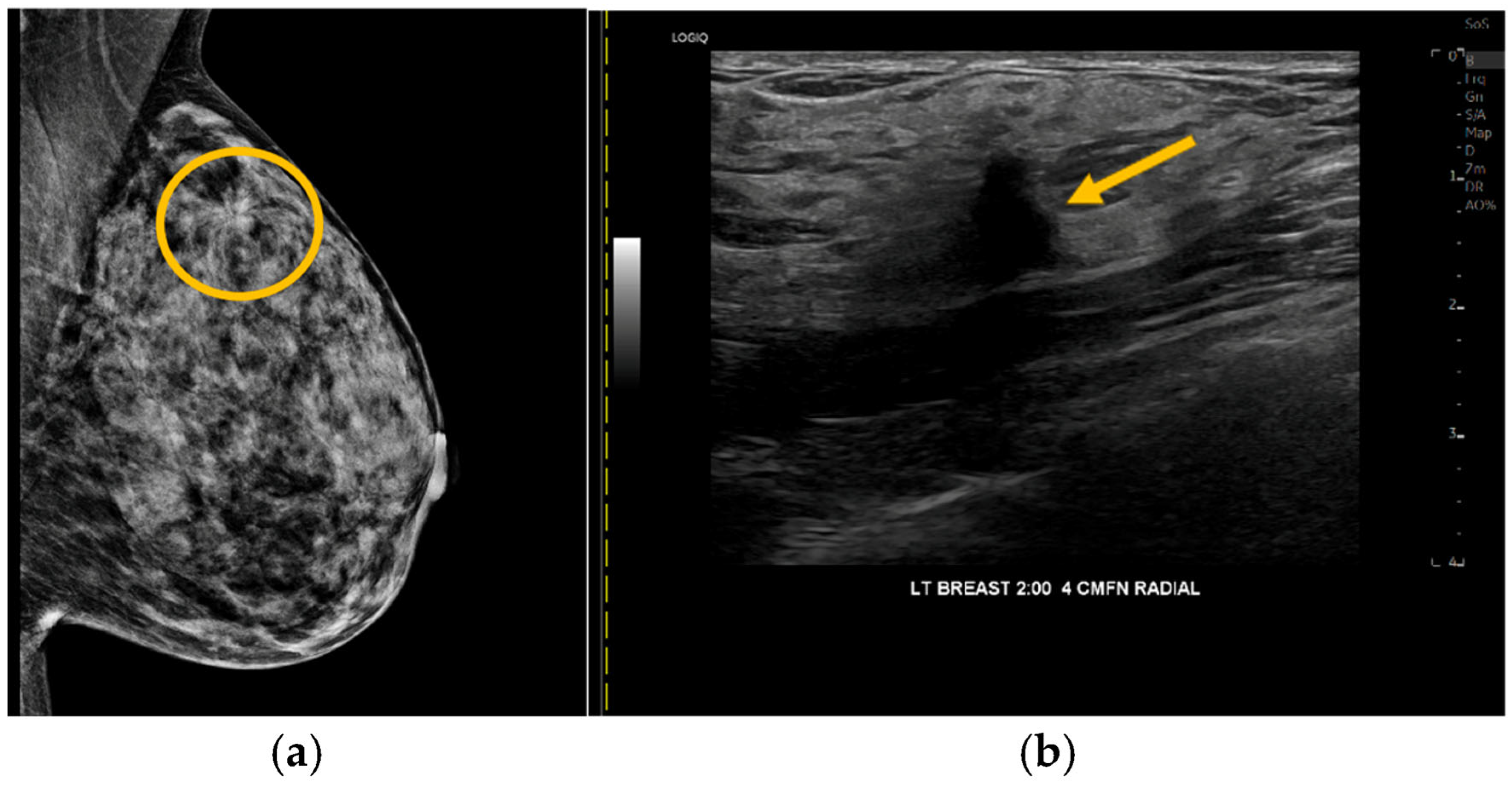 Cancers 18 00281 g003