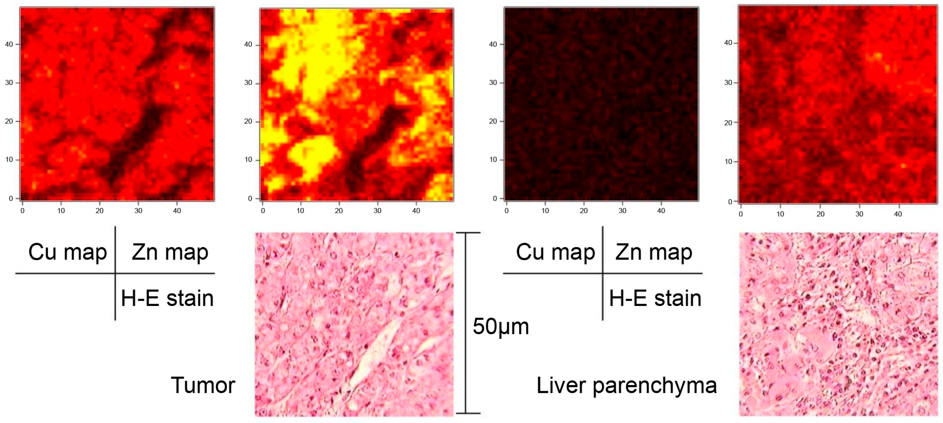 Cancers 18 00311 g002