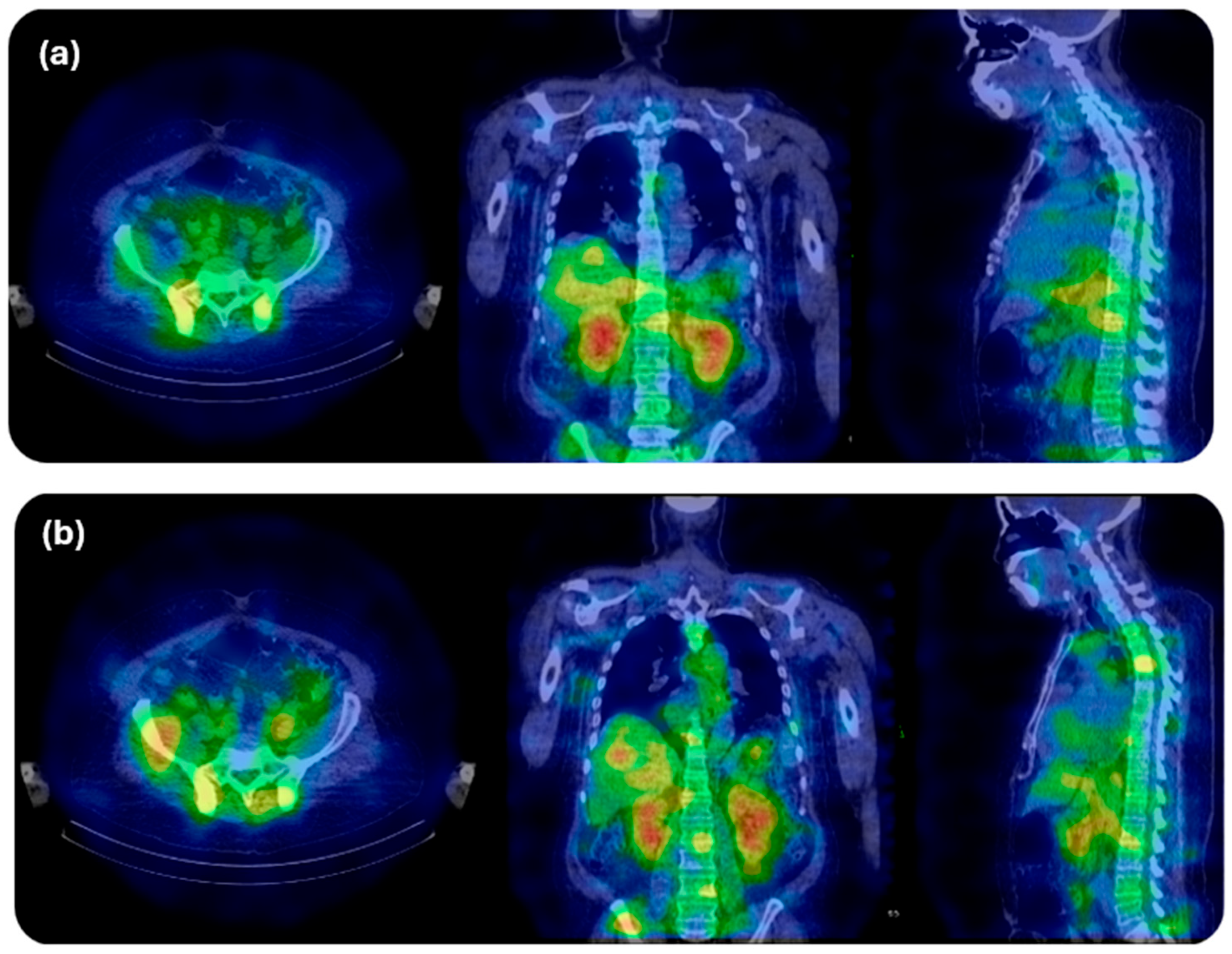 Cancers 18 00321 g007