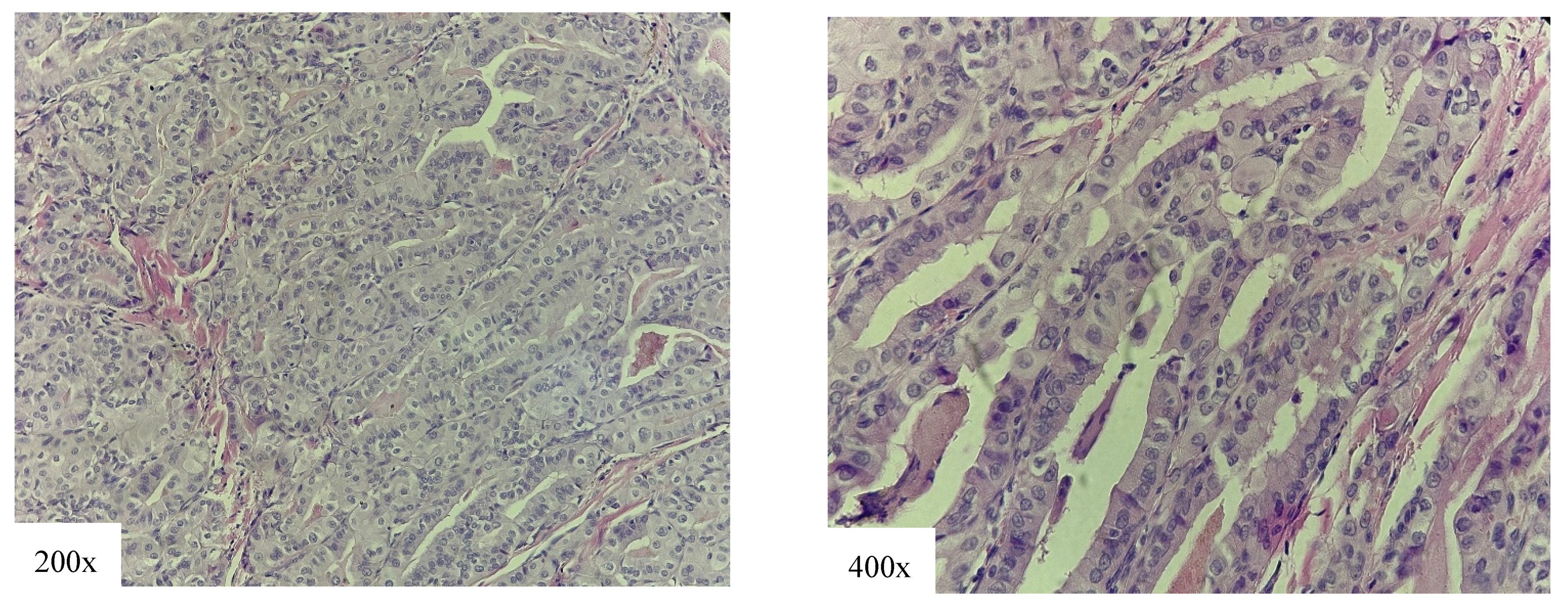 Cancers 18 00345 g004 Cancers 18 00345 g004