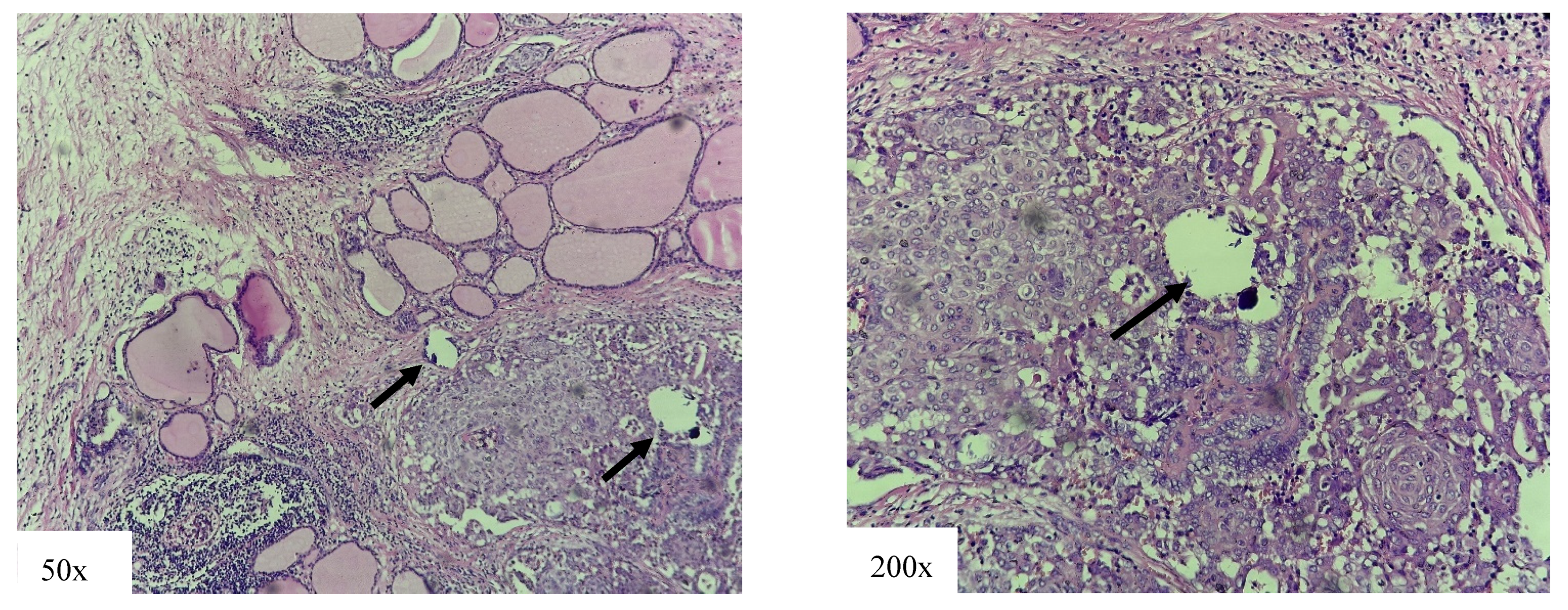 Cancers 18 00345 g005 Cancers 18 00345 g005