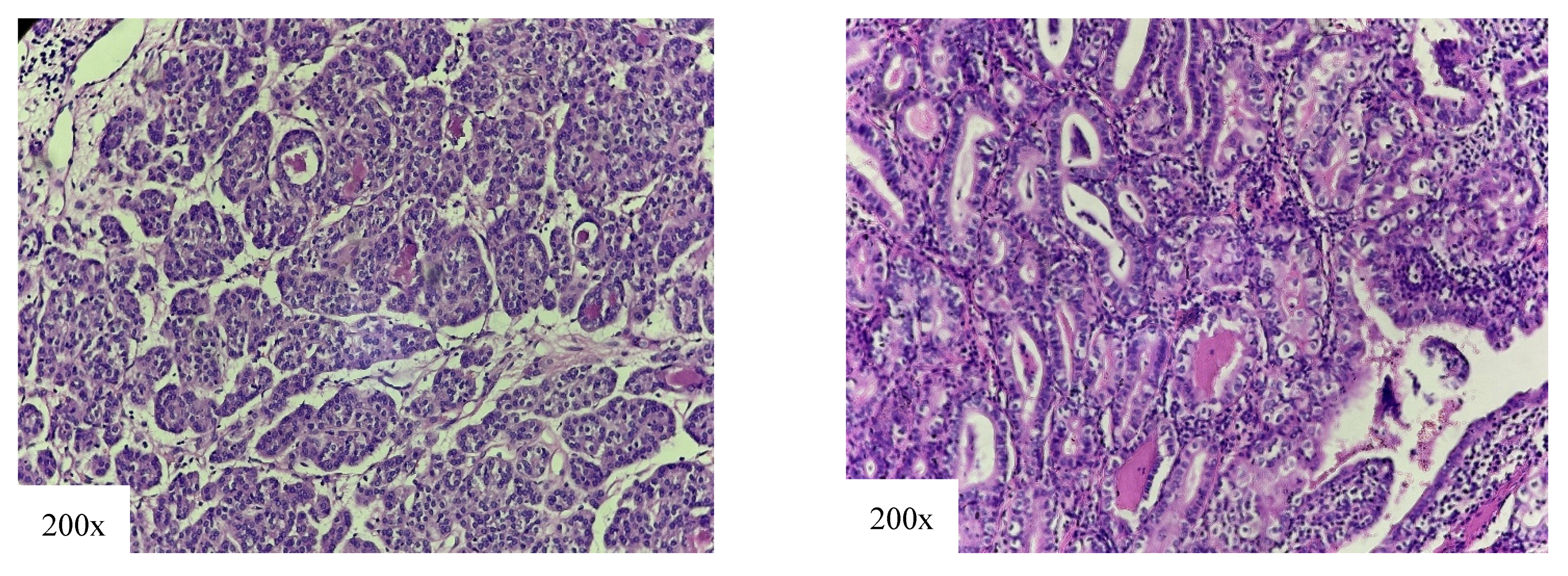 Cancers 18 00345 g006 Cancers 18 00345 g006