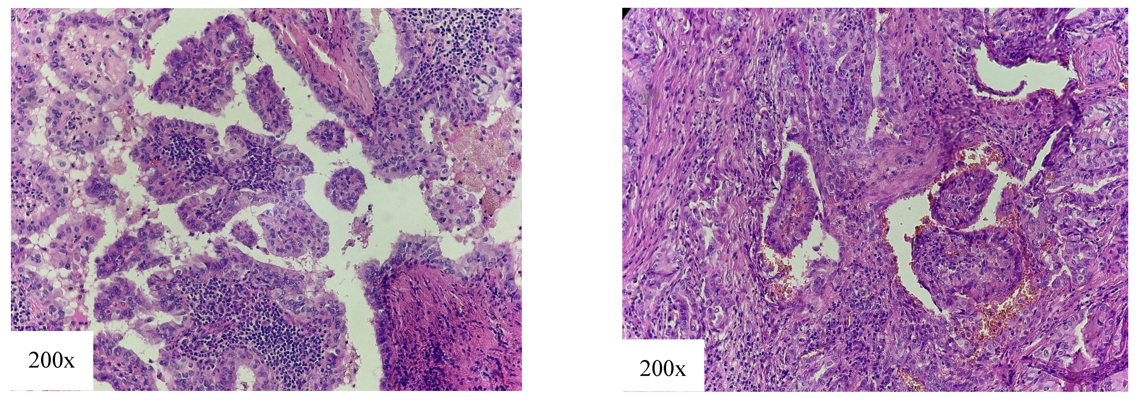 Cancers 18 00345 g007 Cancers 18 00345 g007