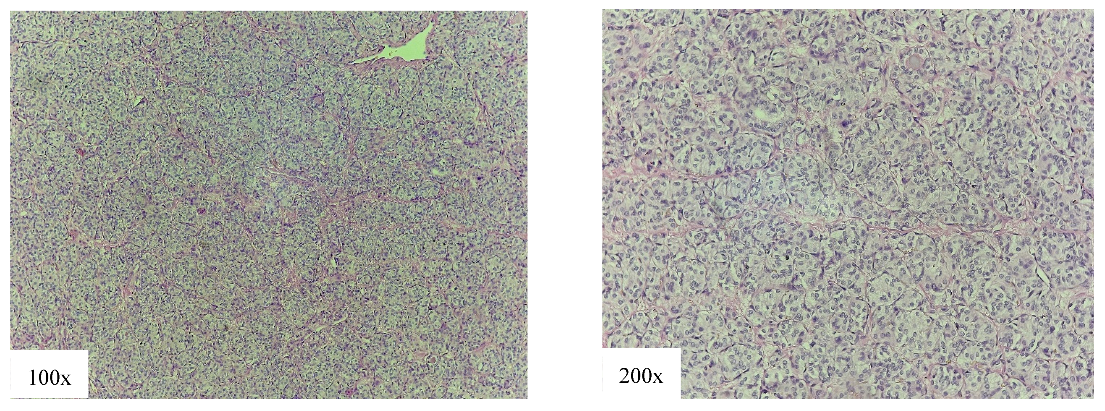 Cancers 18 00345 g008 Cancers 18 00345 g008