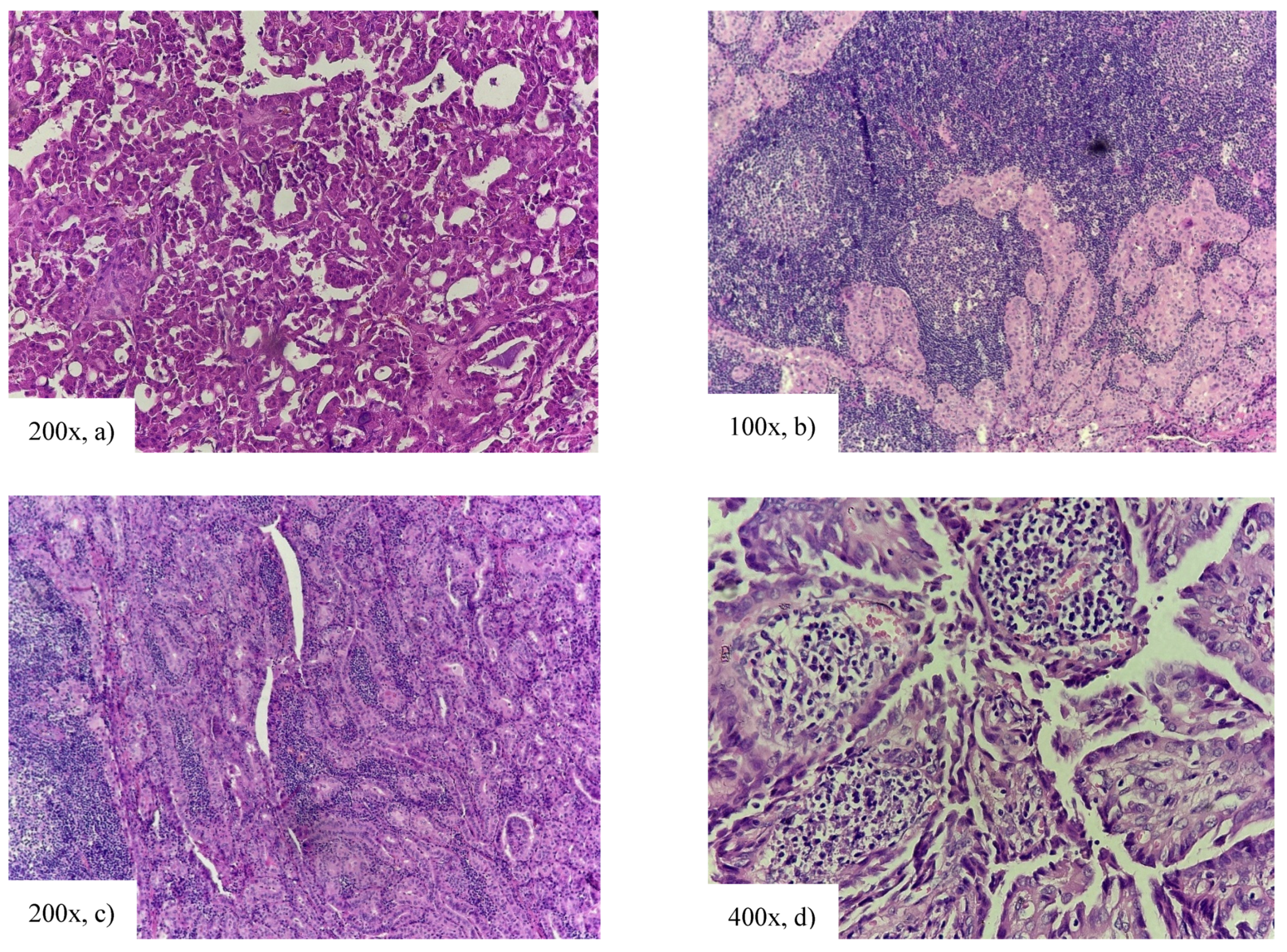 Cancers 18 00345 g009 Cancers 18 00345 g009