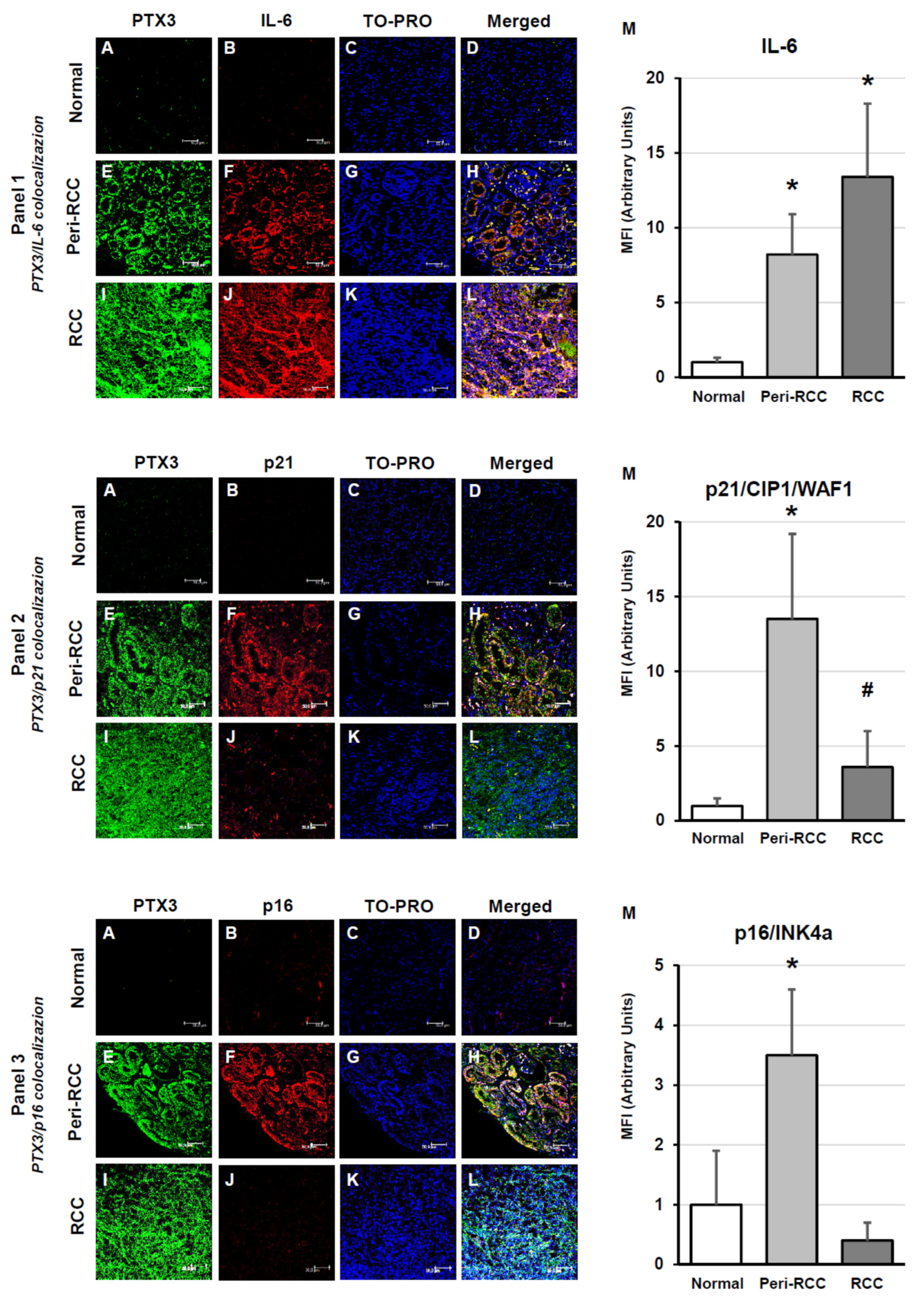 Cancers 18 00414 g003