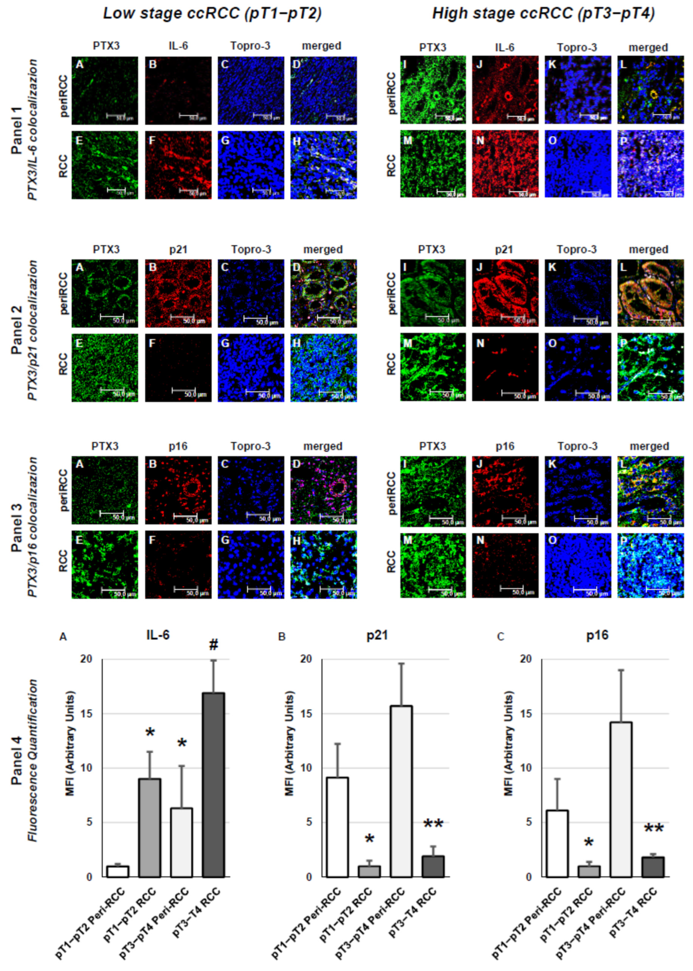 Cancers 18 00414 g007