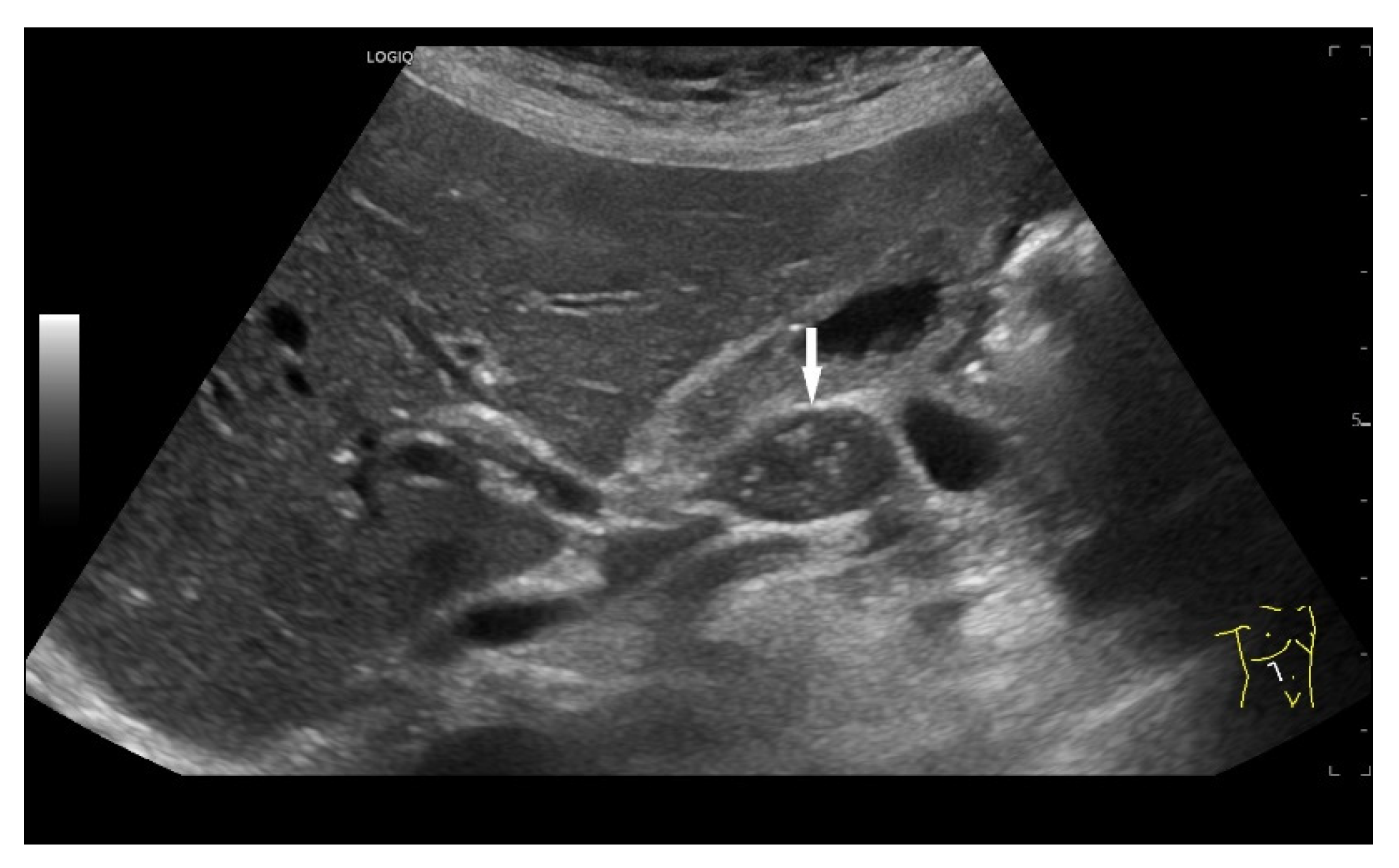 Cancers 18 01045 g012 Cancers 18 01045 g012