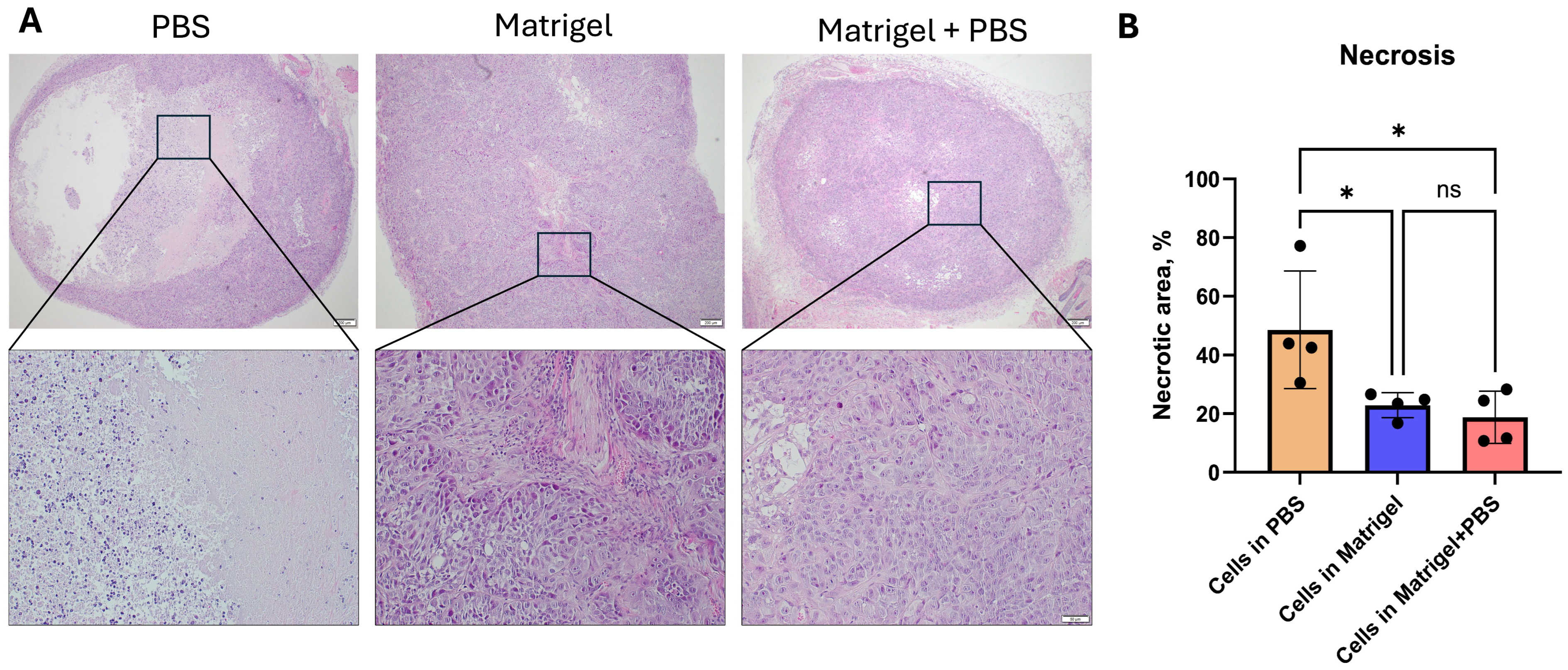 Establishment and Histopathological Characterization of a KYSE-30 Subcutaneous Xenograft Model of Esophageal Squamous Cell Carcinoma