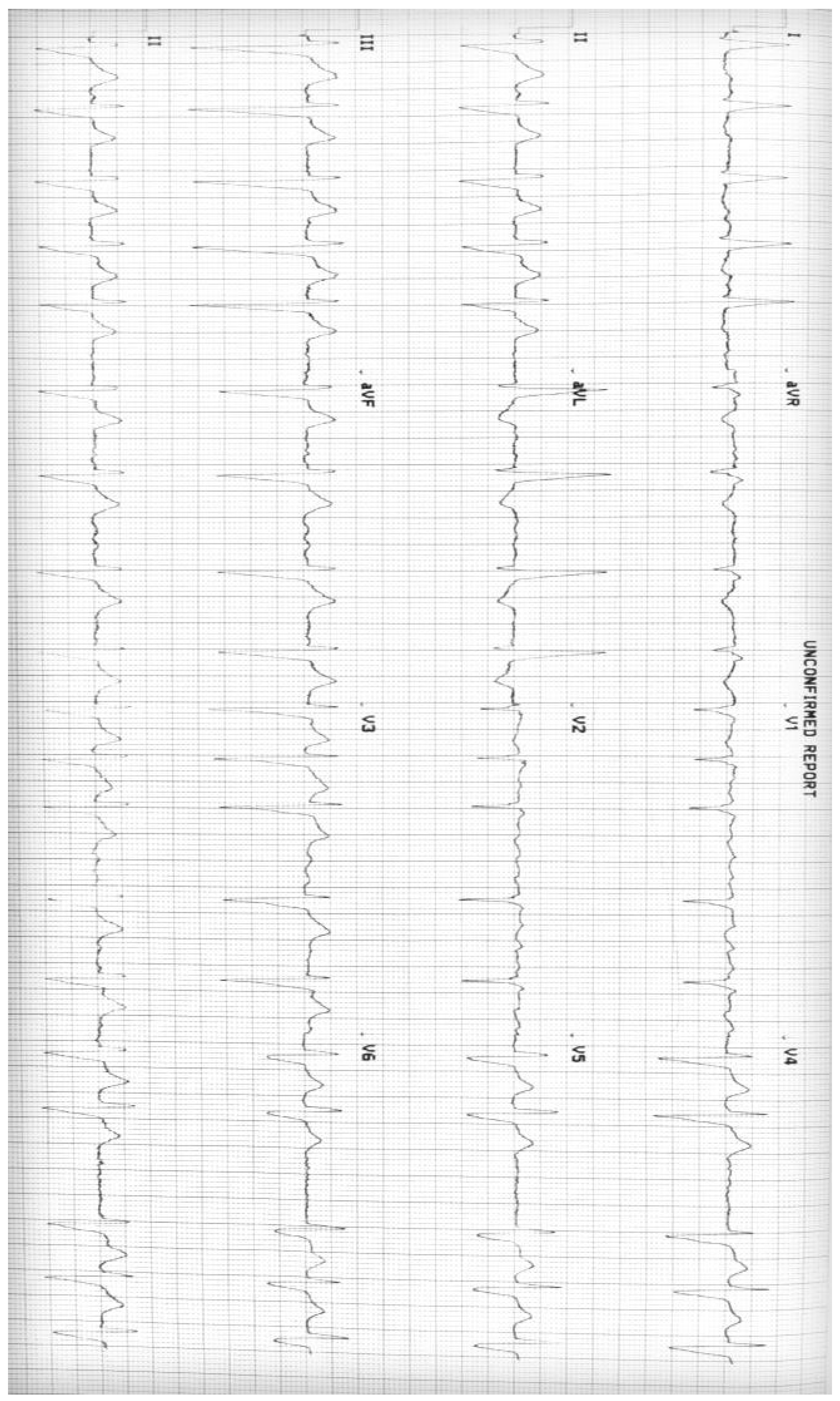 Cardiogenetics 10 00006 g001