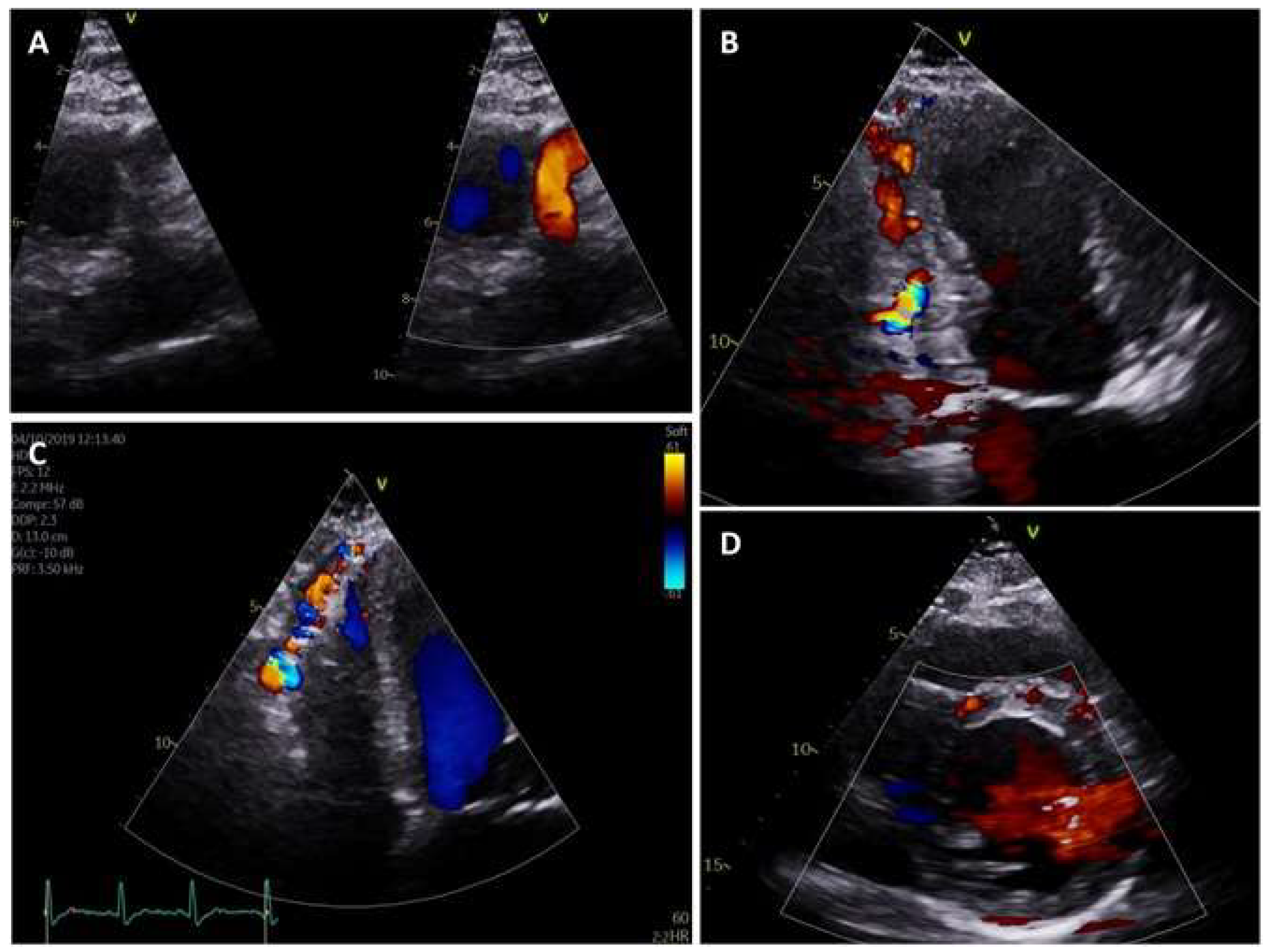 Cardiogenetics 10 00006 g003