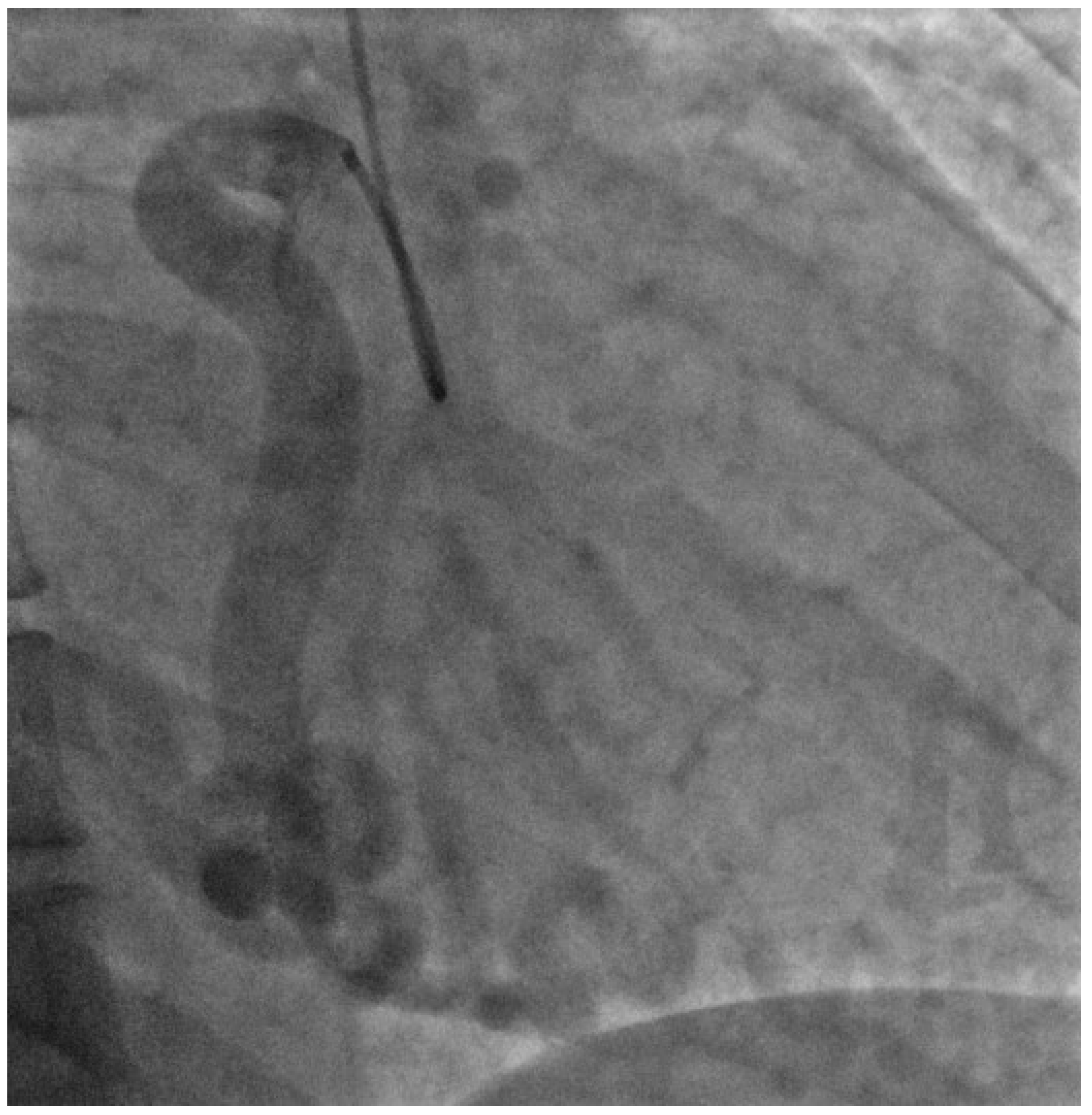 Cardiogenetics 10 00006 g004