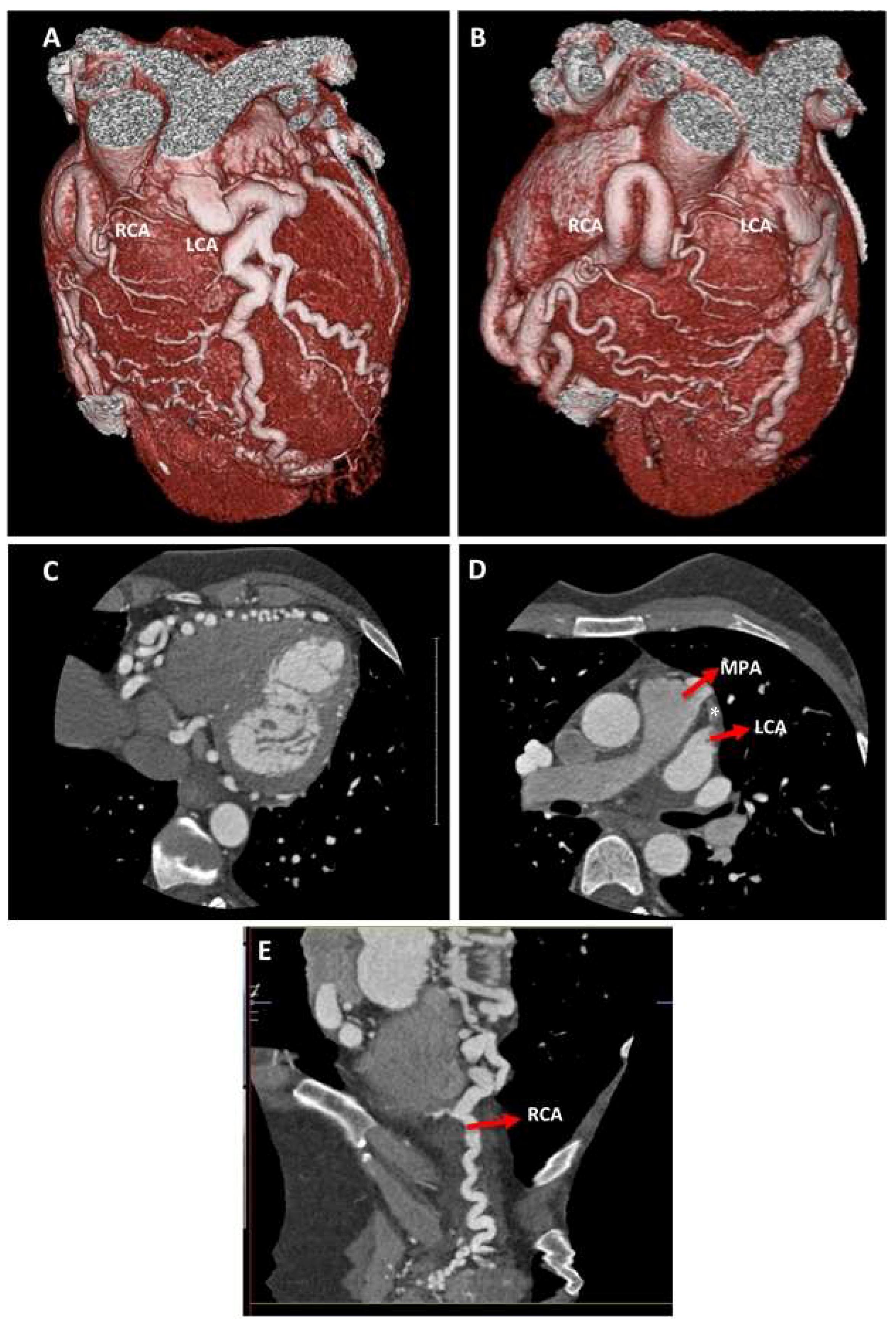 Cardiogenetics 10 00006 g005