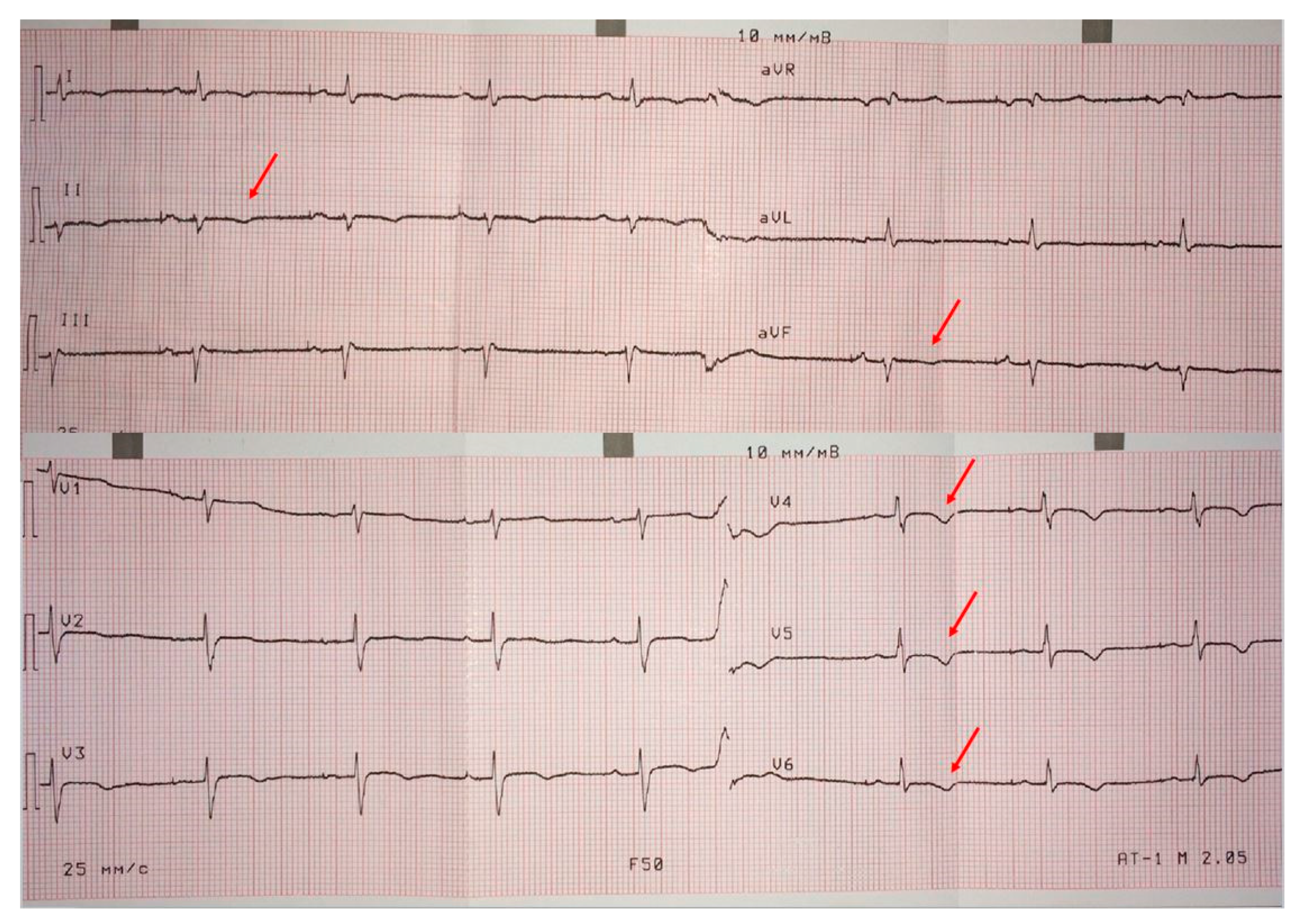 Cardiogenetics 11 00003 g002