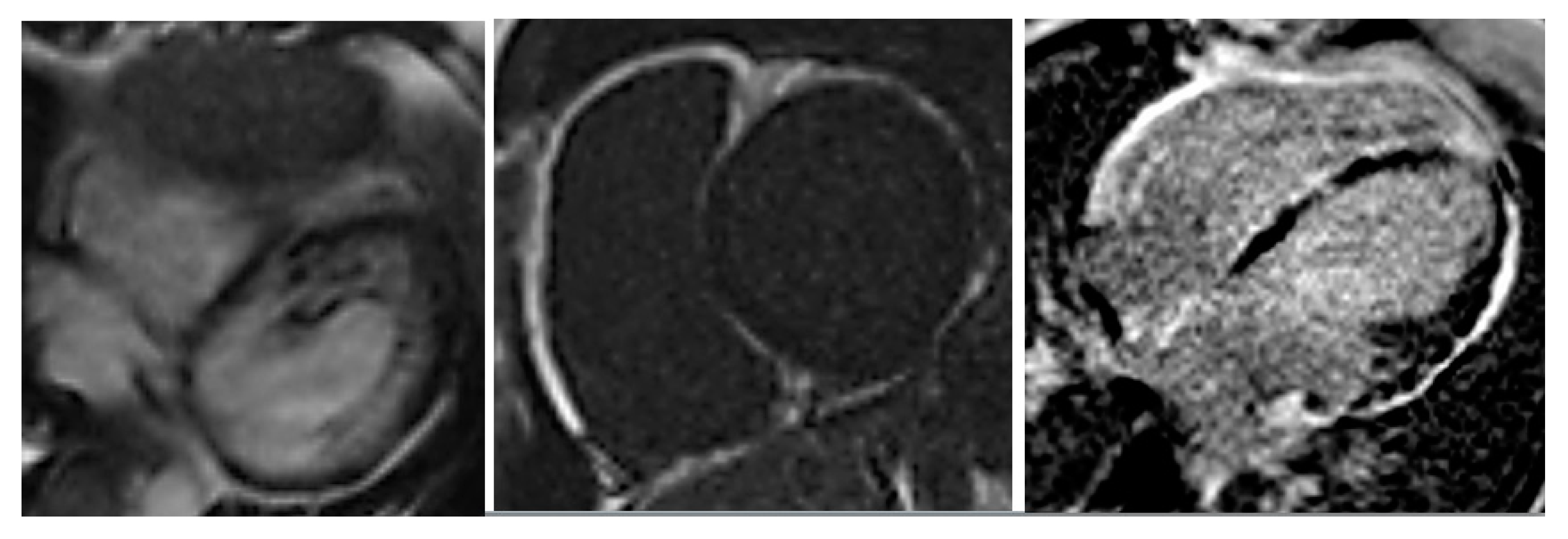 Cardiogenetics 11 00003 g003