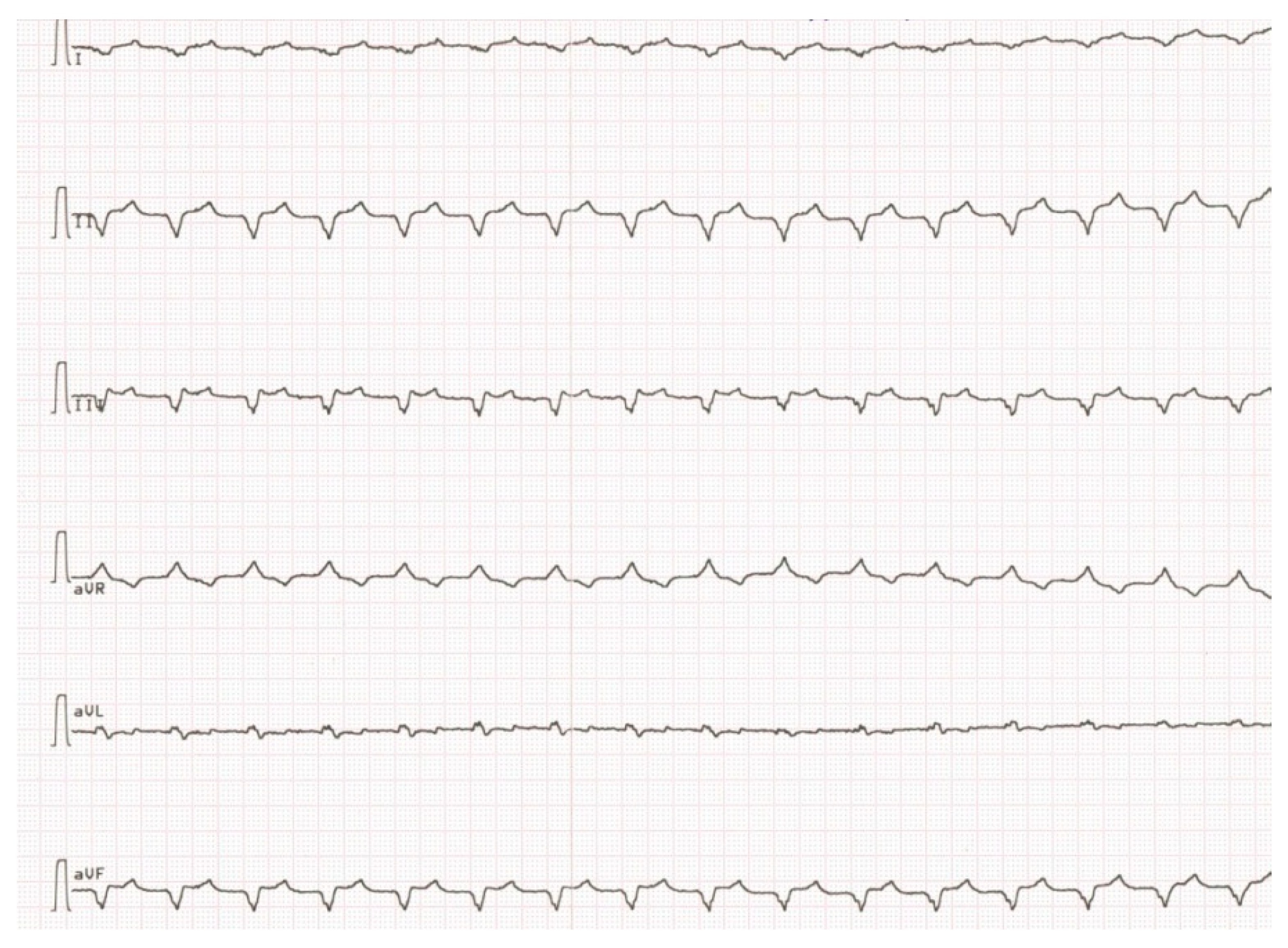 Cardiogenetics 11 00003 g004