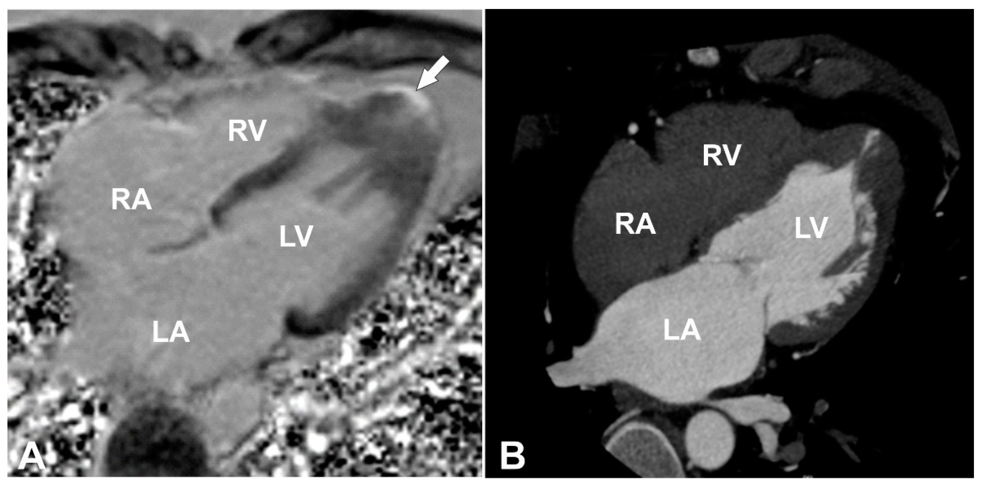 Cardiogenetics 11 00005 g002