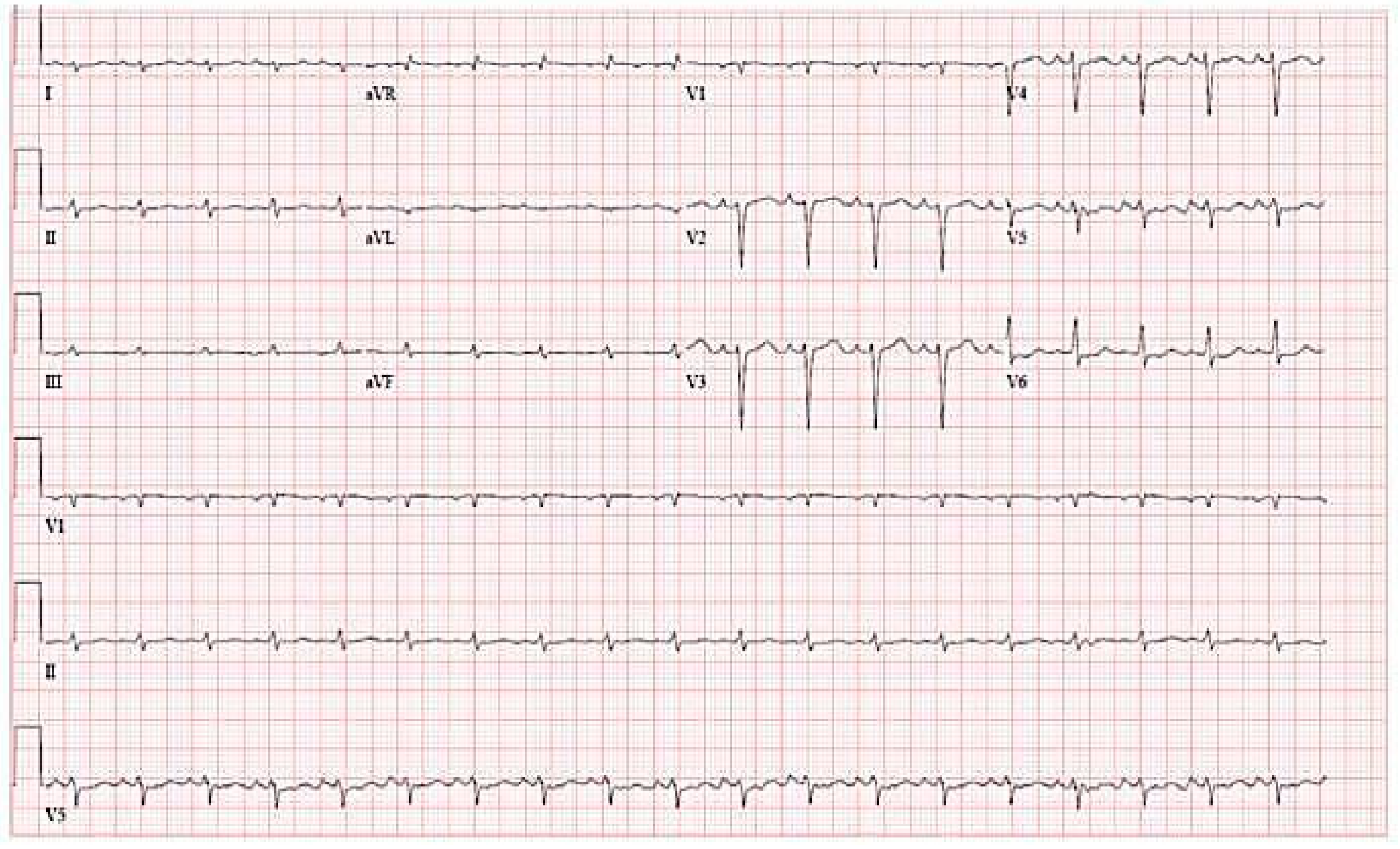 Cardiogenetics 11 00012 g002