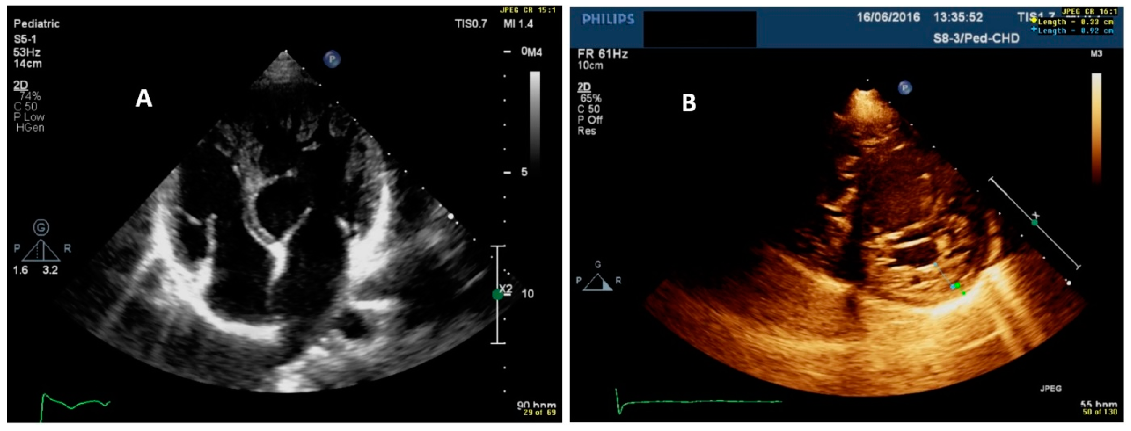 Cardiogenetics 11 00020 g002