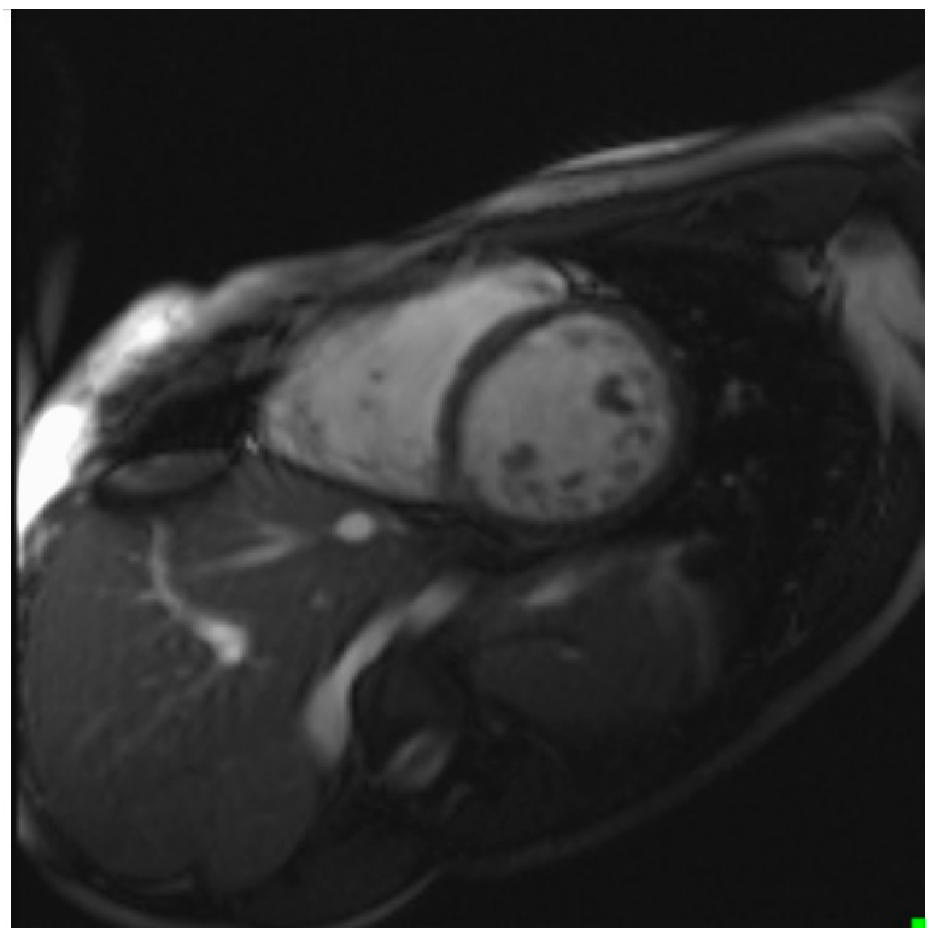 Cardiogenetics 11 00020 g003