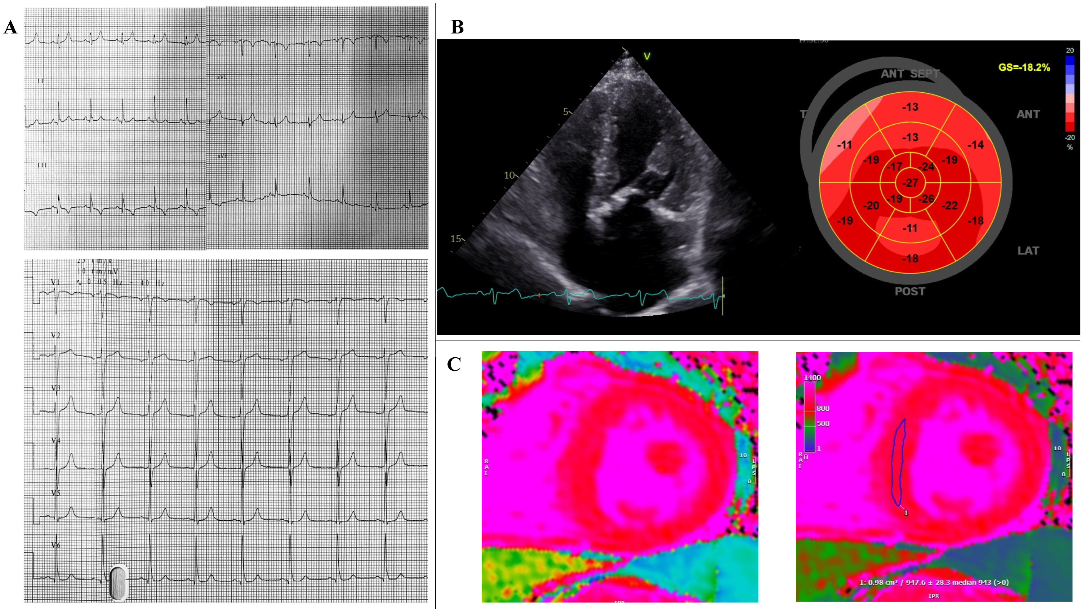 Cardiogenetics 12 00010 g001 550