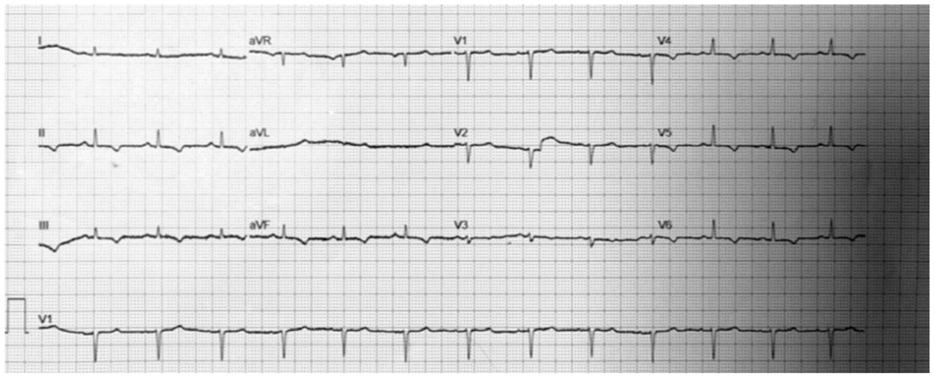Cardiogenetics 12 00014 g002