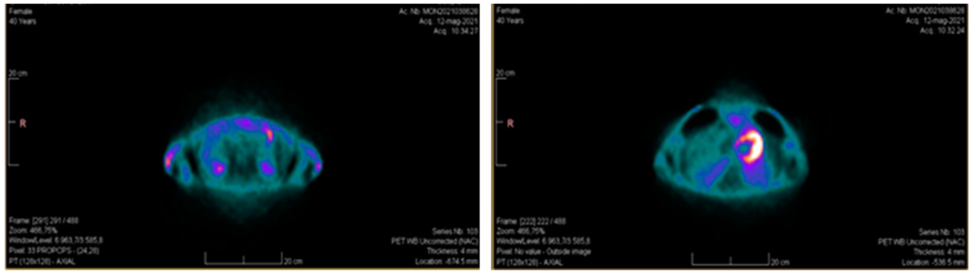 Cardiogenetics 12 00014 g005