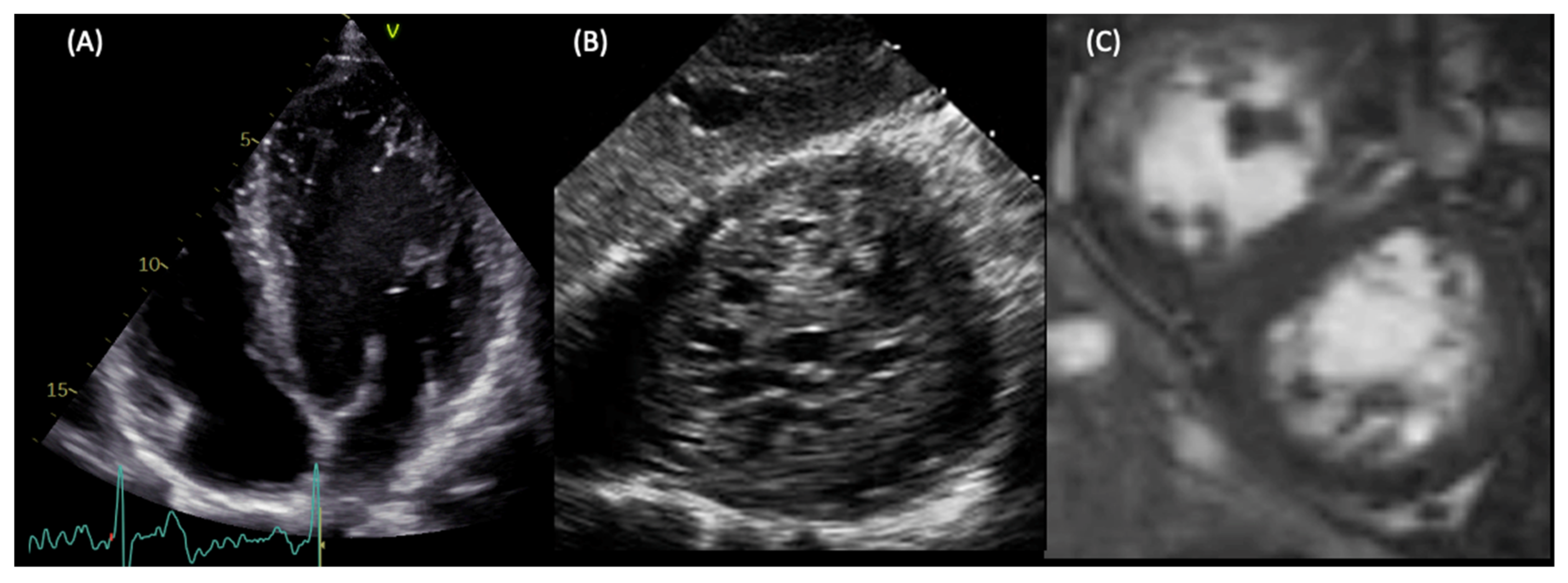 Cardiogenetics 12 00016 g002 Cardiogenetics 12 00016 g002