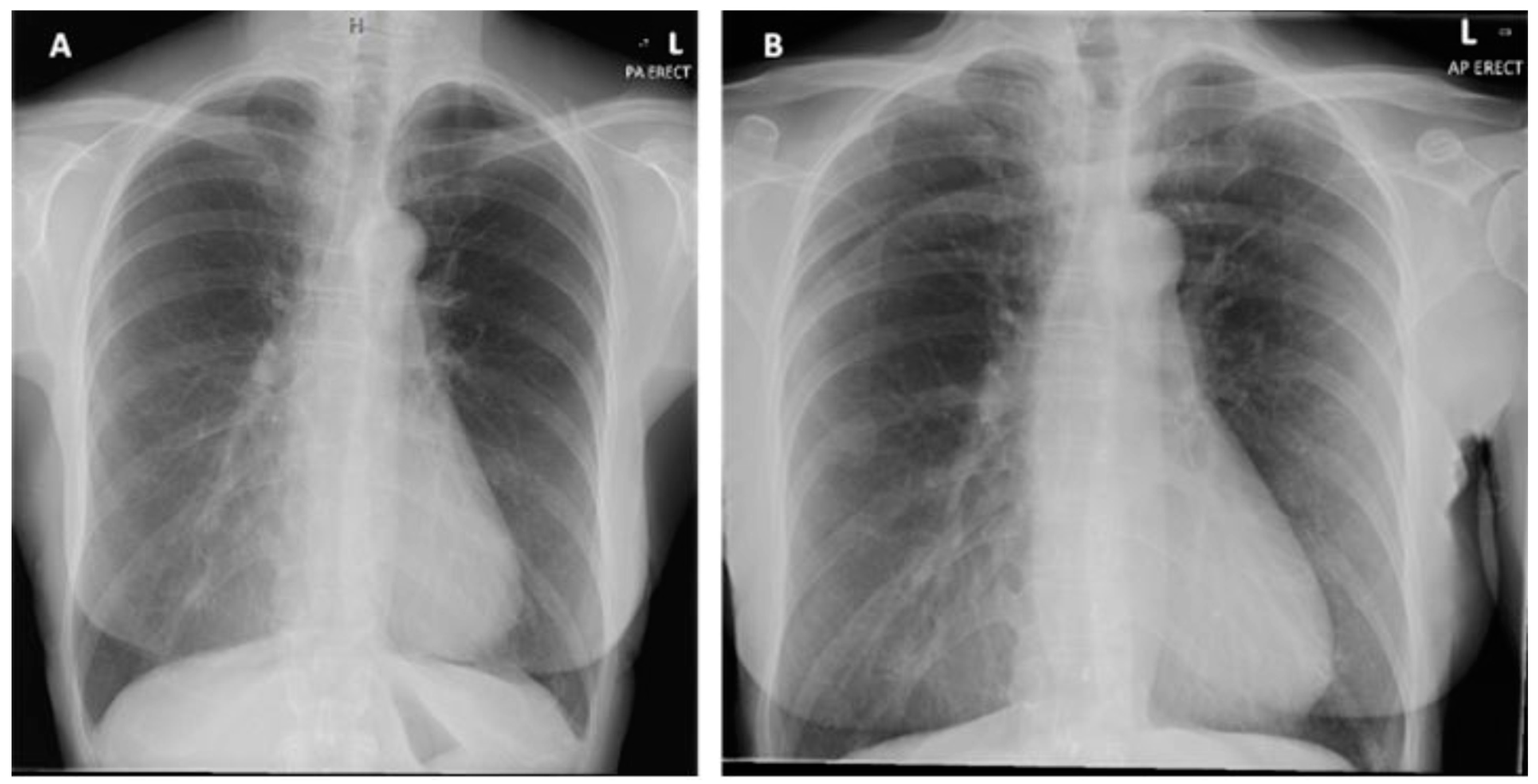 Cardiogenetics 12 00023 g002 550