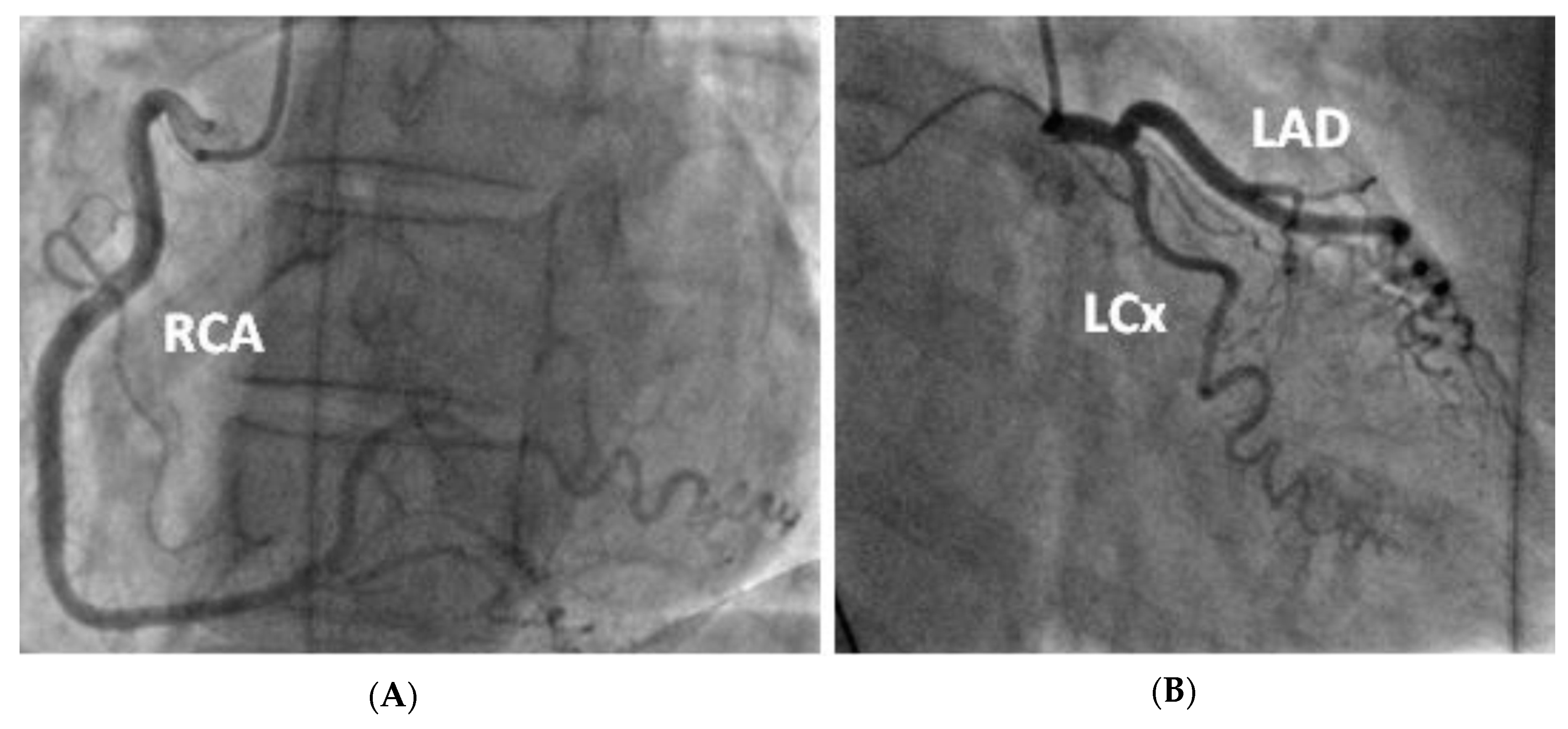 Cardiogenetics 12 00023 g003 550